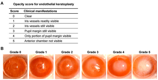 Spk Grading Assessment of Corneal Graft Outcomes in a Murine Model of Endothelial ...