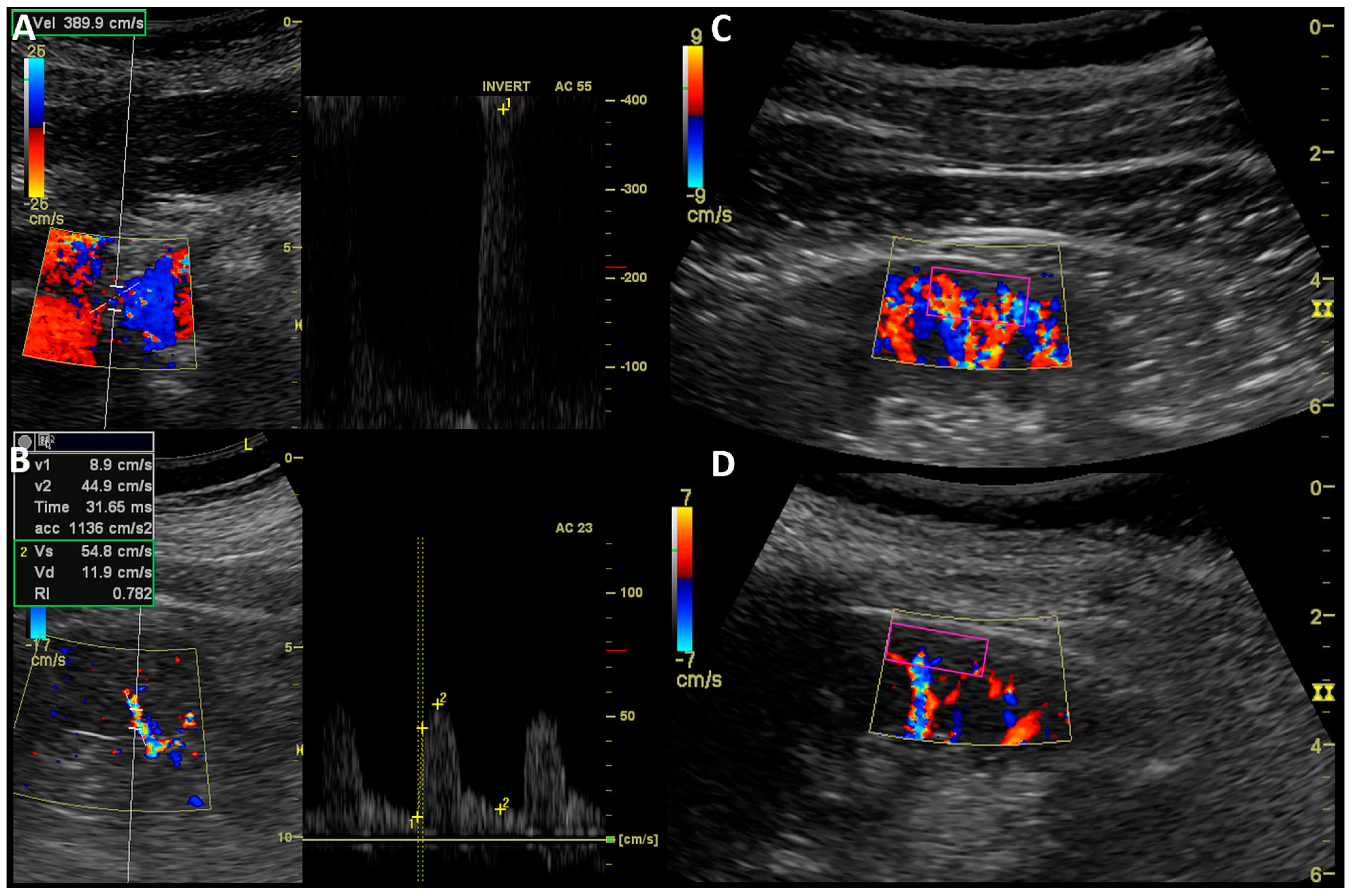 Jcm 13 05022 g003 Jcm 13 05022 g003