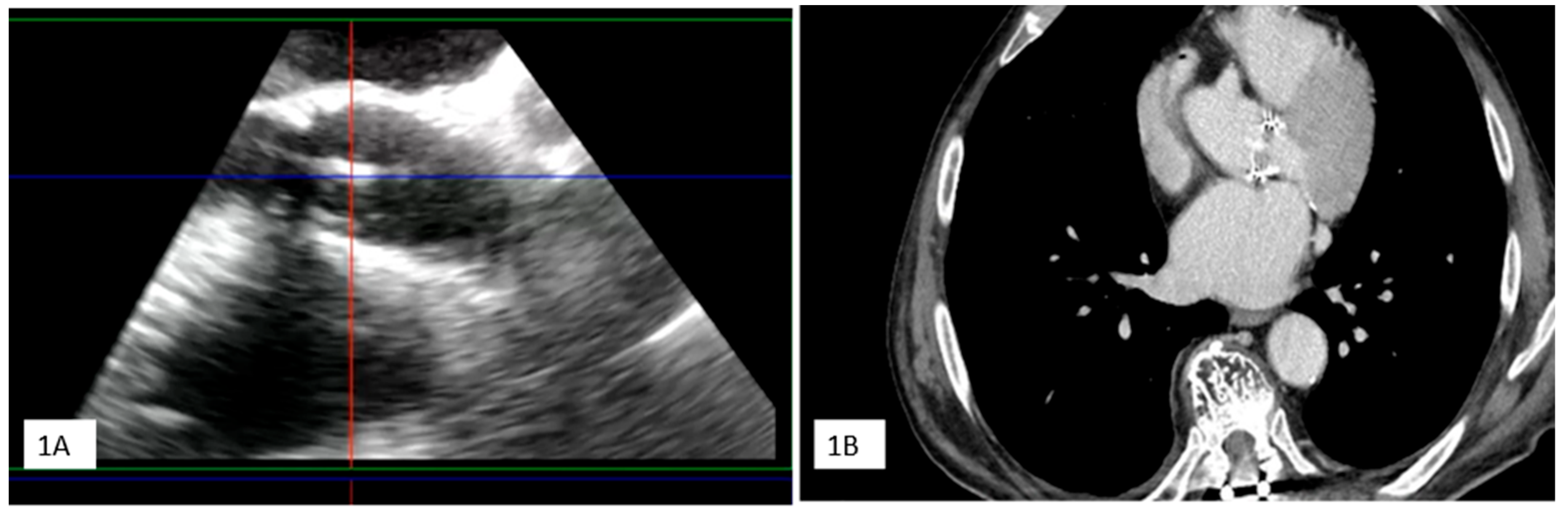 Jcm 13 05058 i004a Jcm 13 05058 i004a