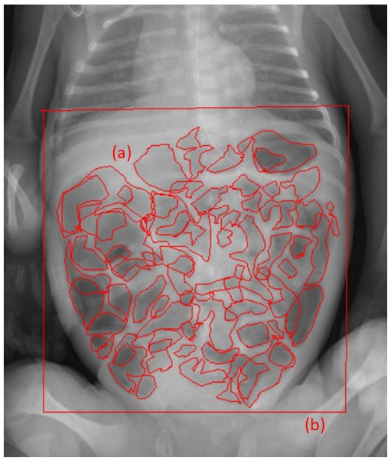 Jcm 13 05082 g001 Jcm 13 05082 g001