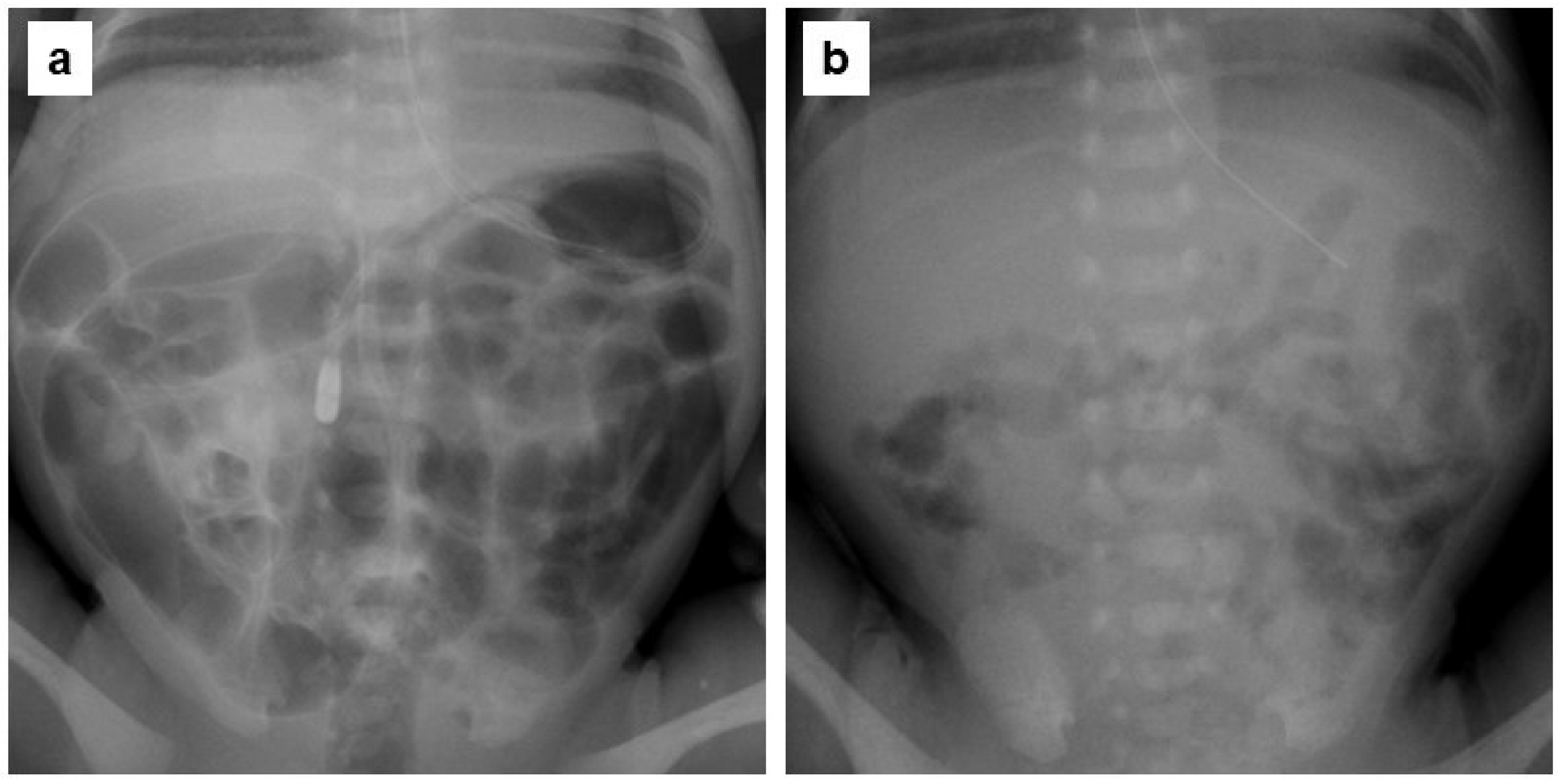 Jcm 13 05082 g003 Jcm 13 05082 g003