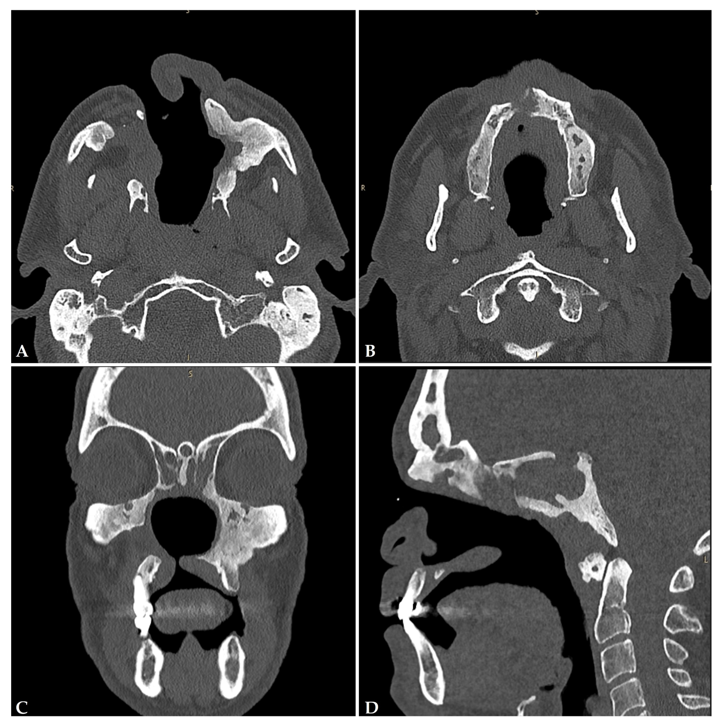 Jcm 13 05116 g004 Jcm 13 05116 g004