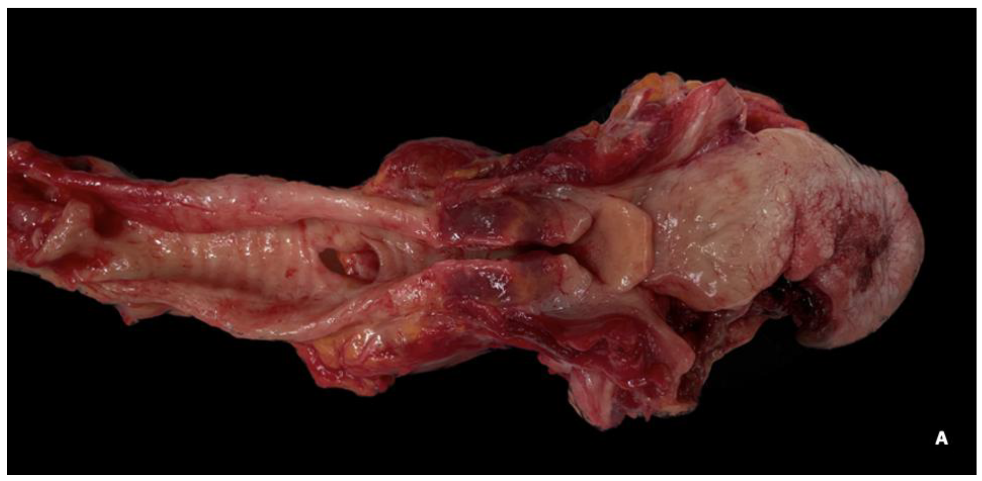 Jcm 13 05198 g002a Jcm 13 05198 g002a