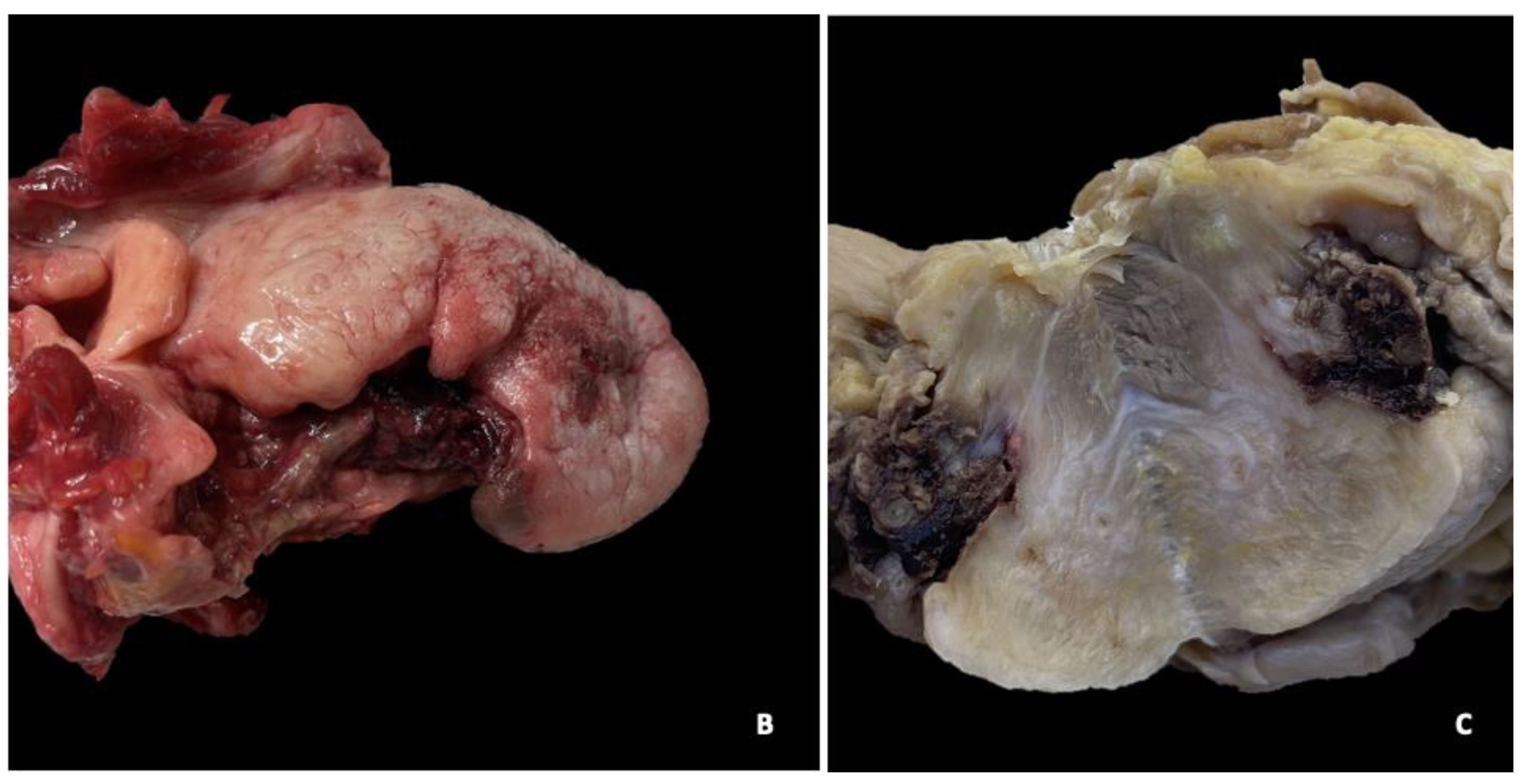 Jcm 13 05198 g002b Jcm 13 05198 g002b