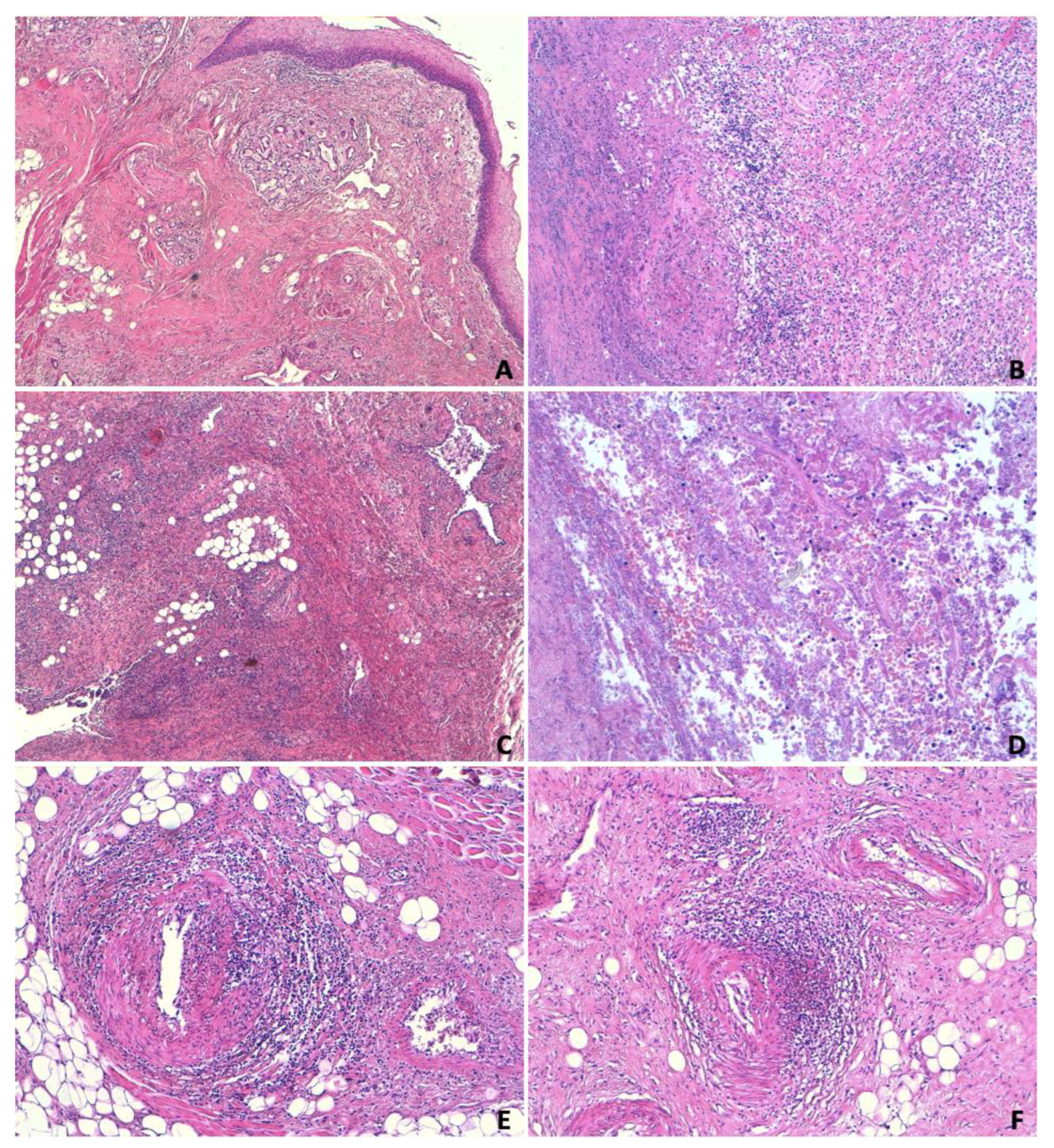 Jcm 13 05198 g003 Jcm 13 05198 g003