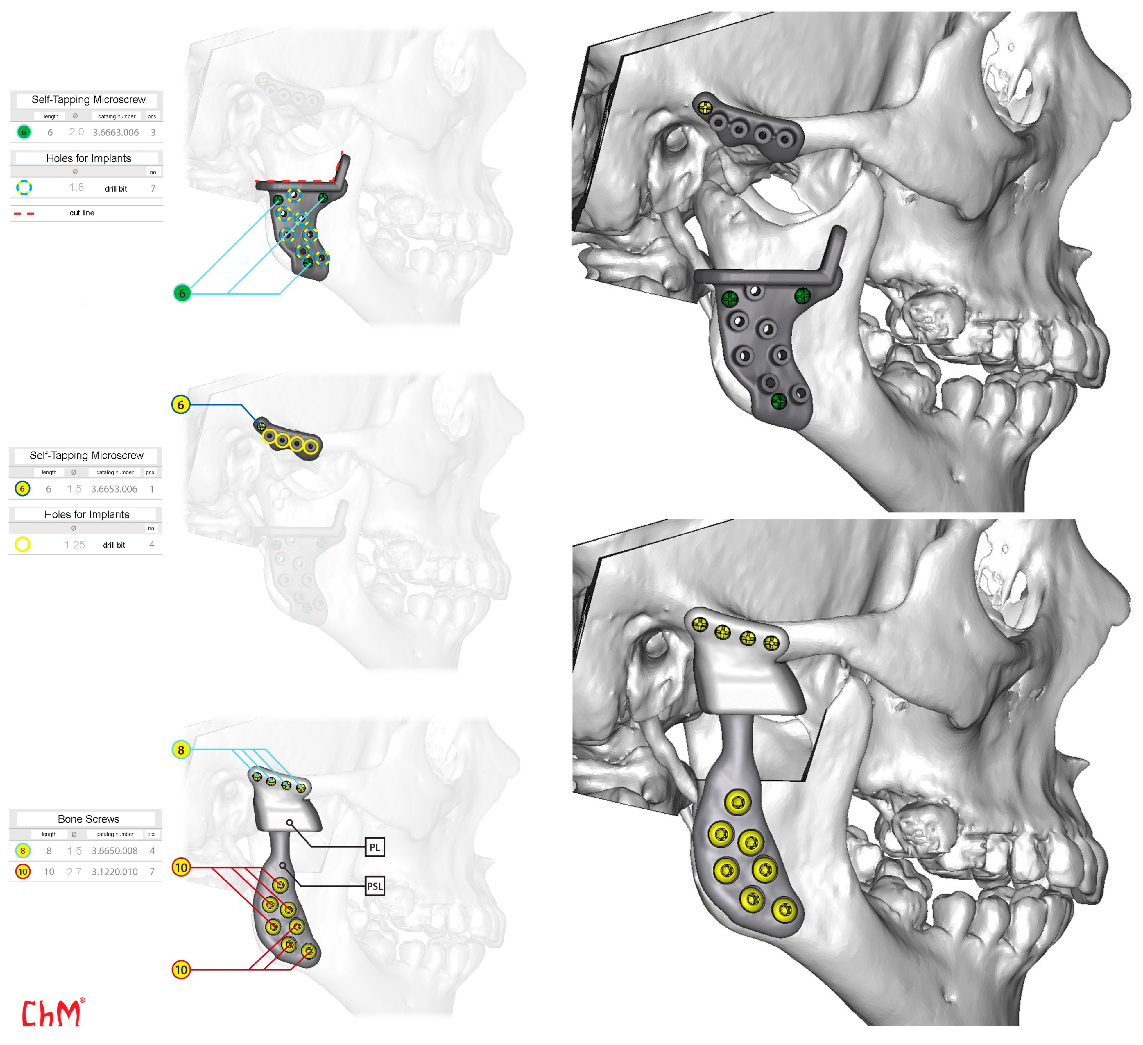Jcm 13 05257 g008 Jcm 13 05257 g008