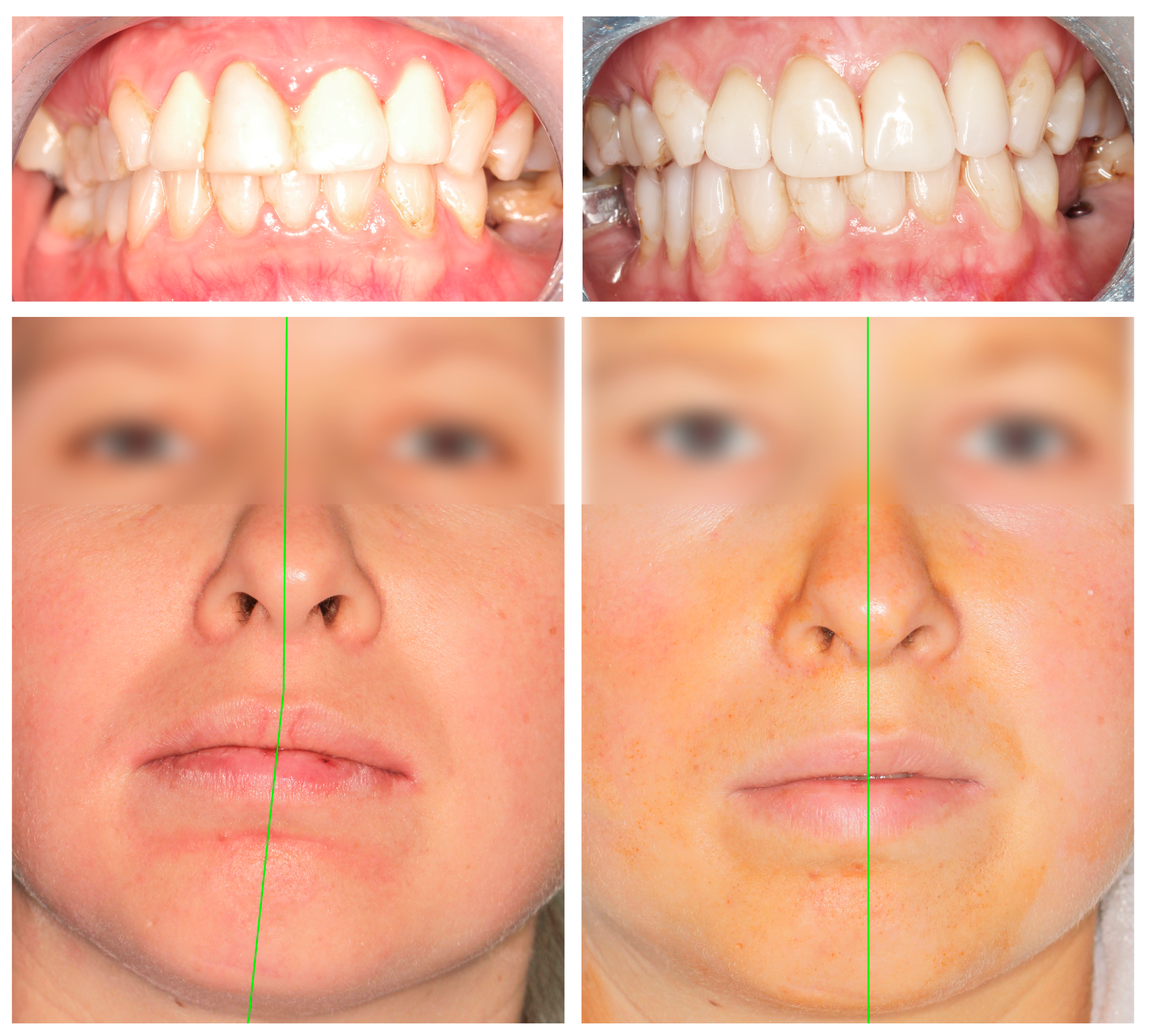 Jcm 13 05257 g010 Jcm 13 05257 g010