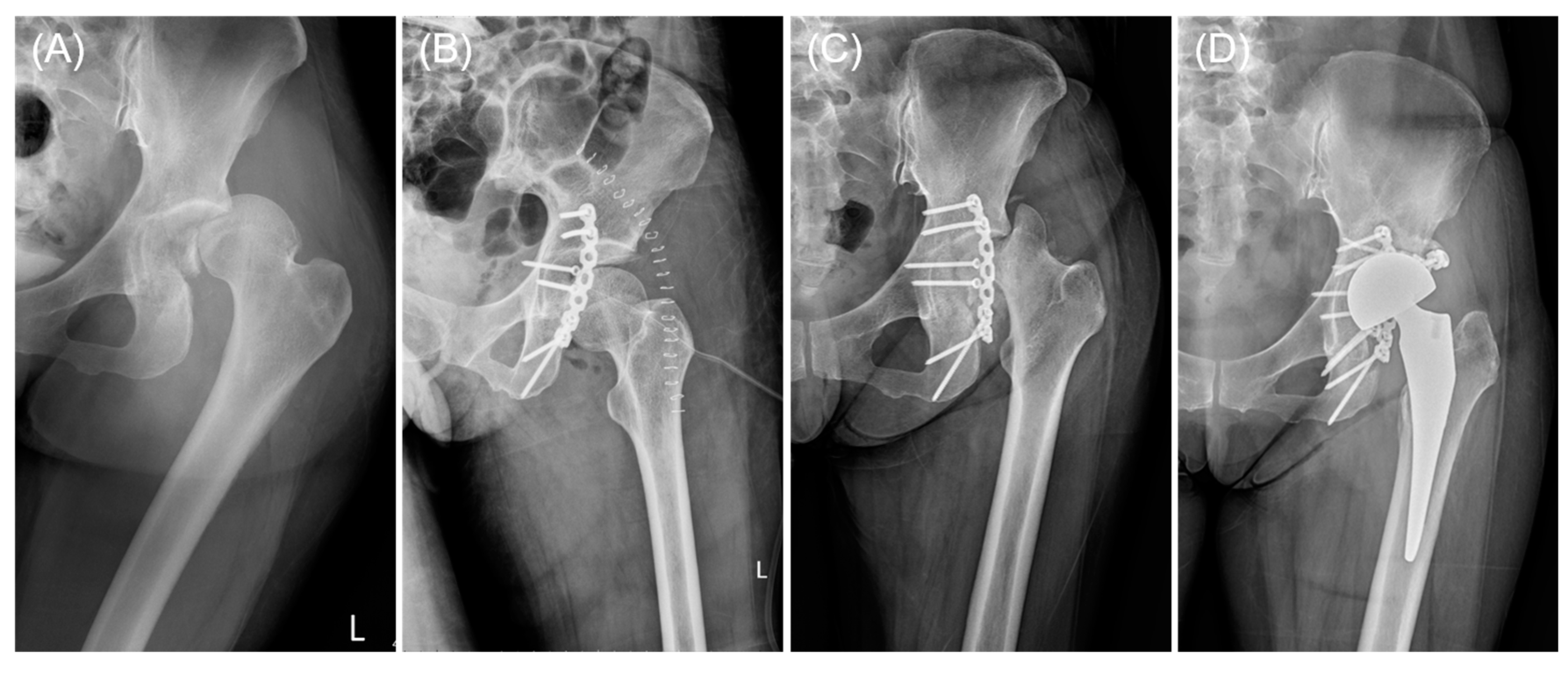 Jcm 13 05341 g004 Jcm 13 05341 g004