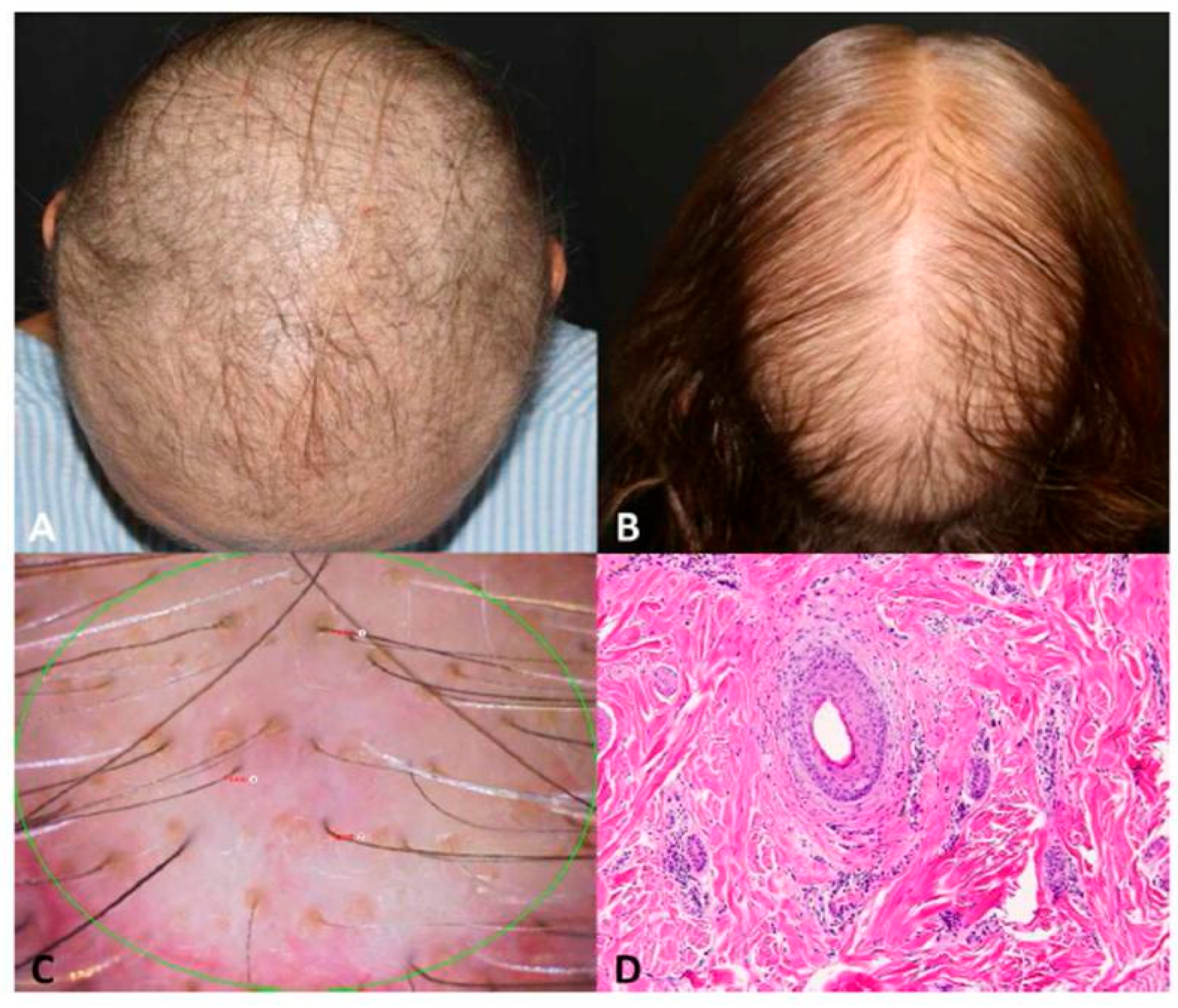 Jcm 13 05397 g002 Jcm 13 05397 g002