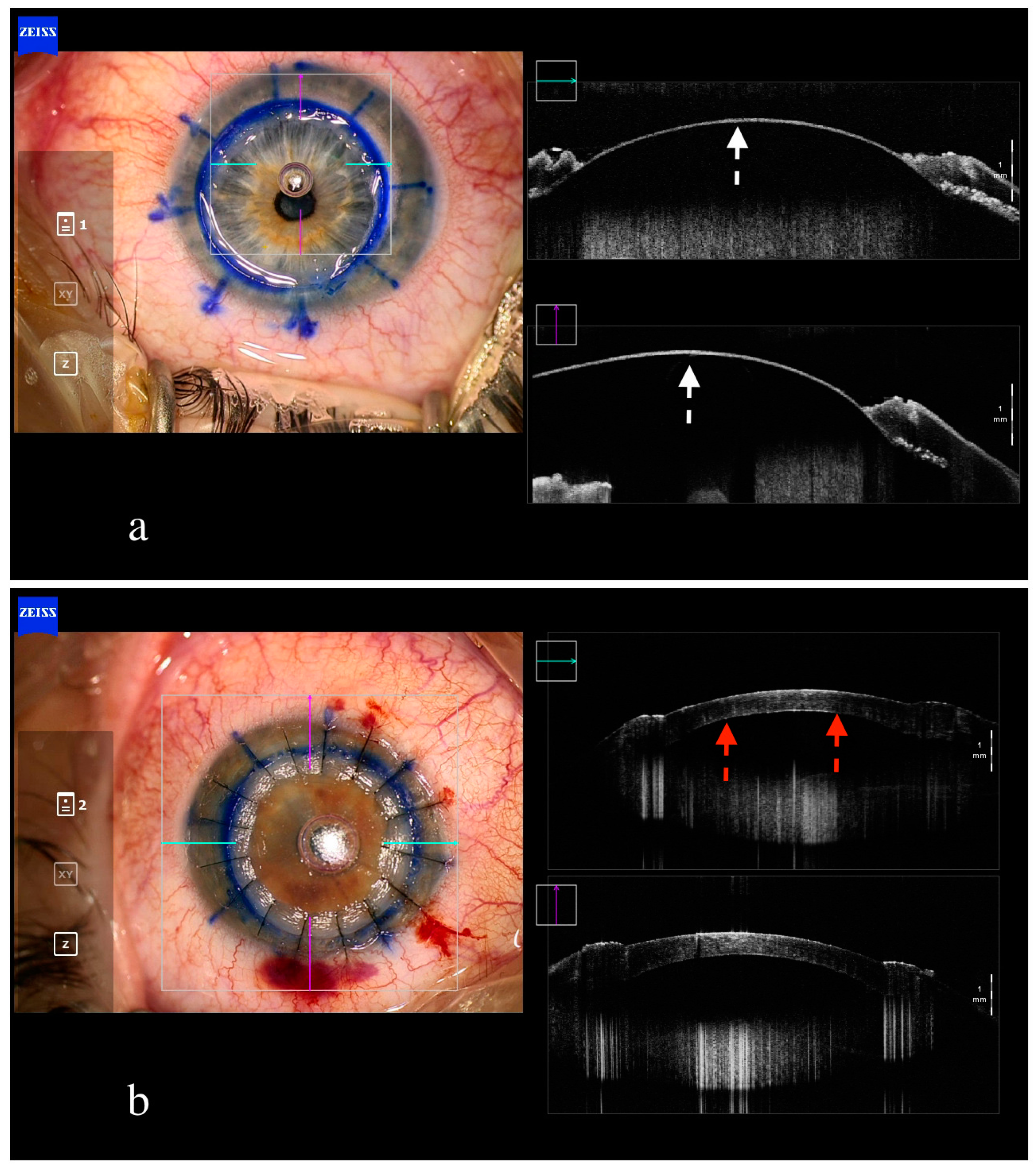 Jcm 13 05426 g001 Jcm 13 05426 g001