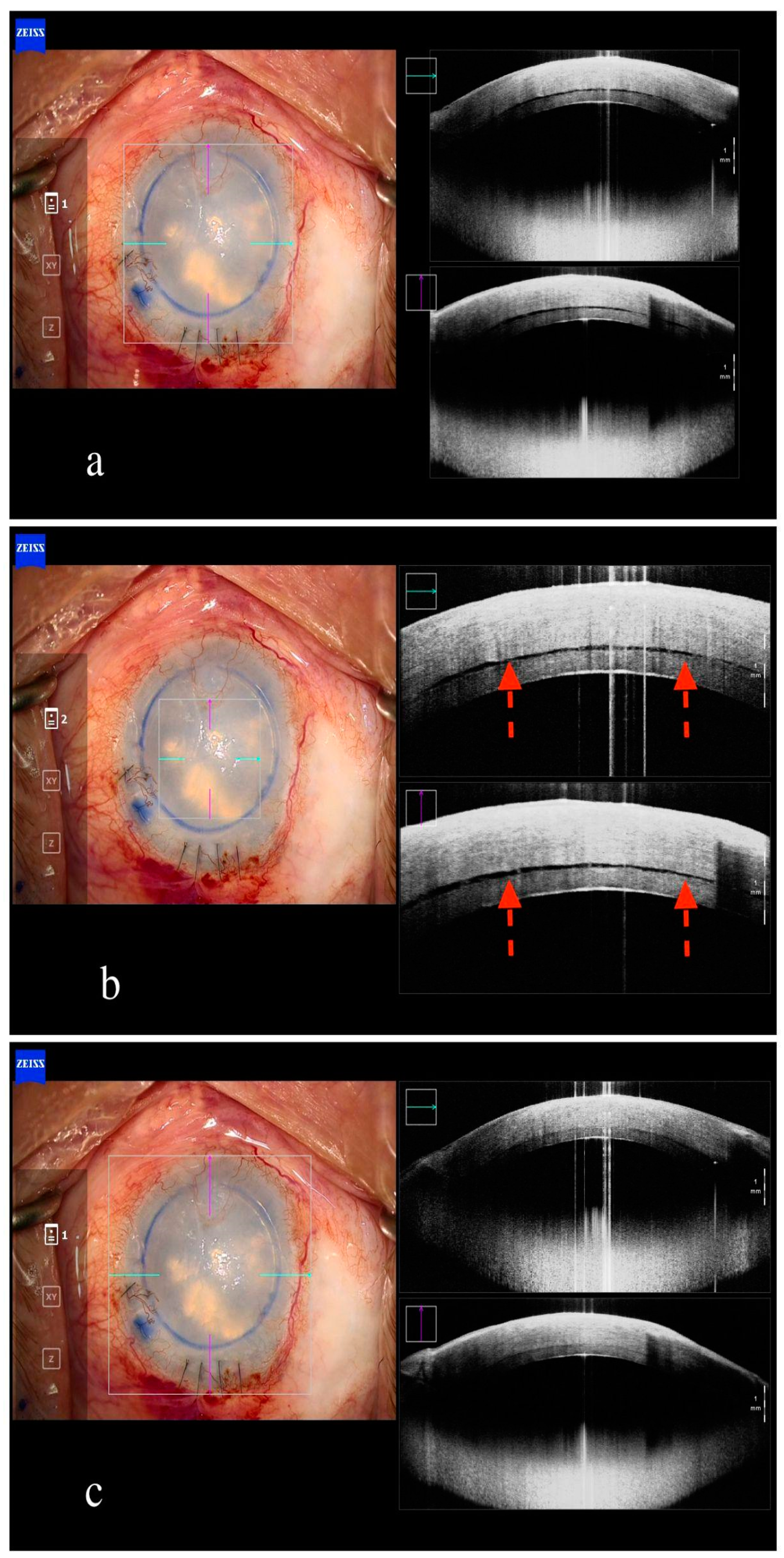 Jcm 13 05426 g003 Jcm 13 05426 g003