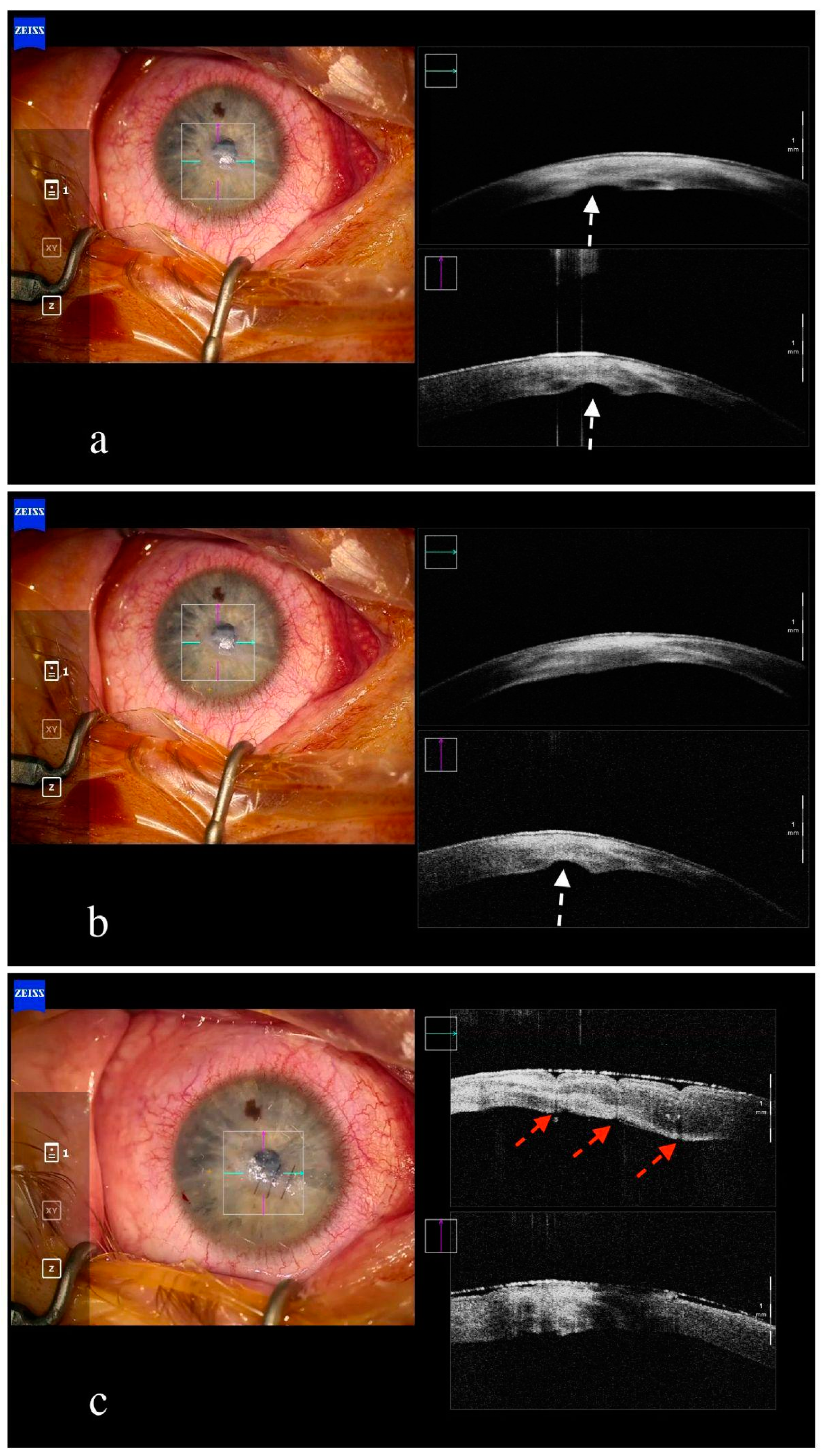 Jcm 13 05426 g004 Jcm 13 05426 g004