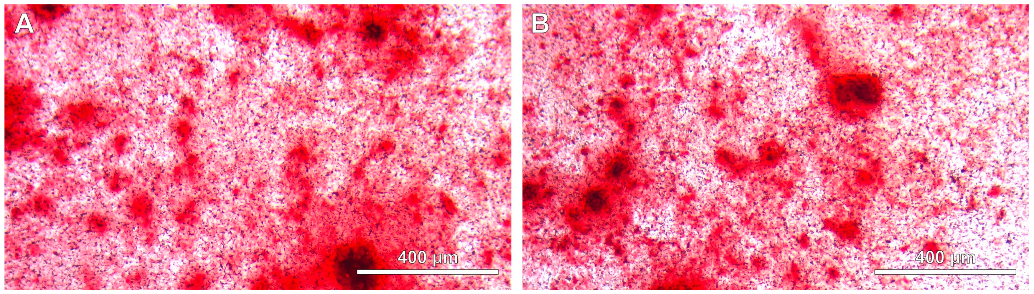 Jcm 13 05465 g003 Jcm 13 05465 g003