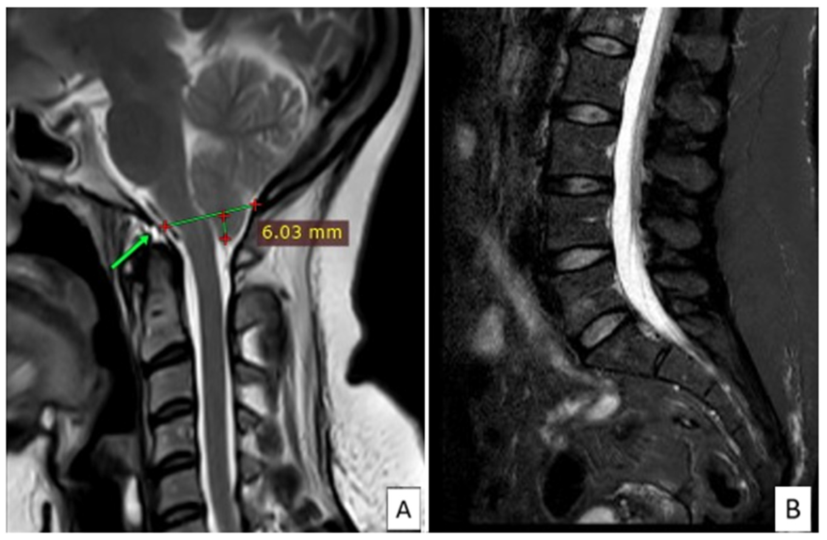 Jcm 13 05502 g003 Jcm 13 05502 g003