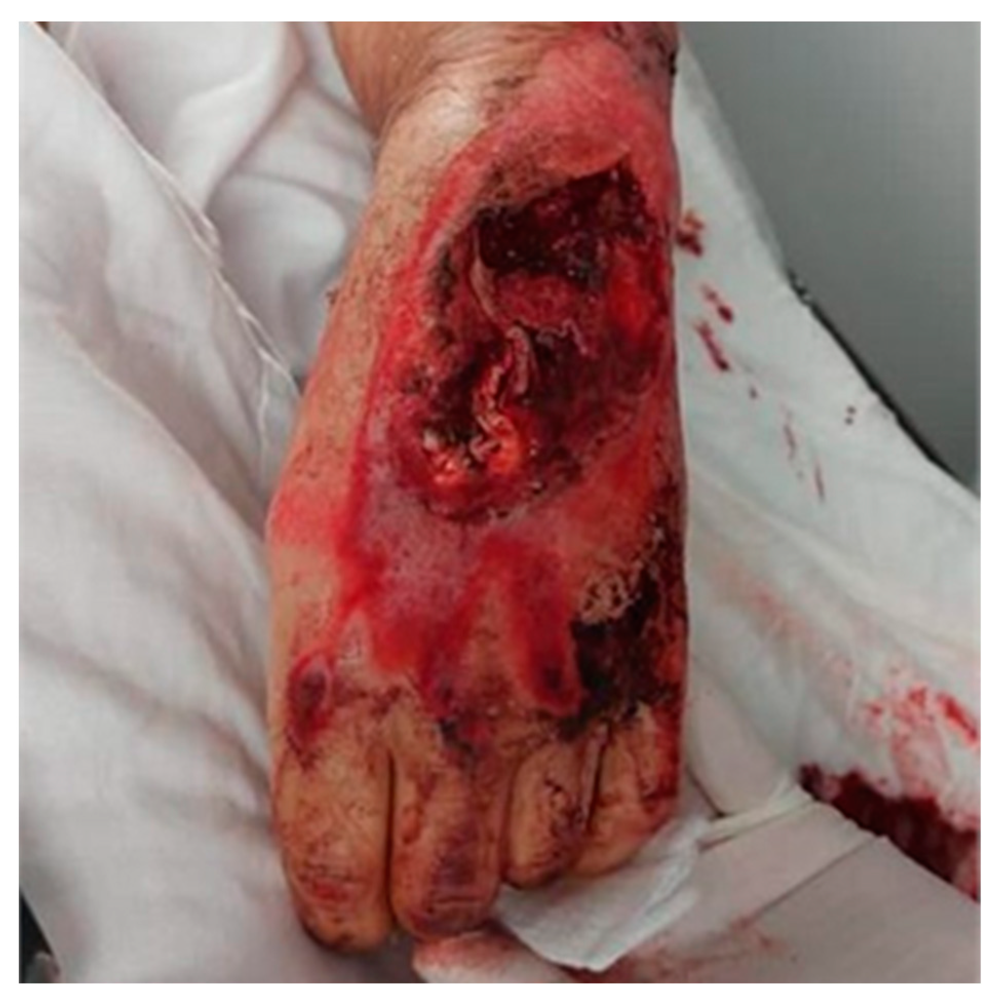 Jcm 13 05640 g001 Jcm 13 05640 g001