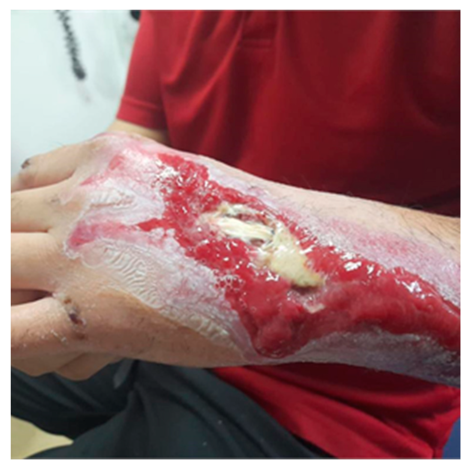 Jcm 13 05640 g002 Jcm 13 05640 g002