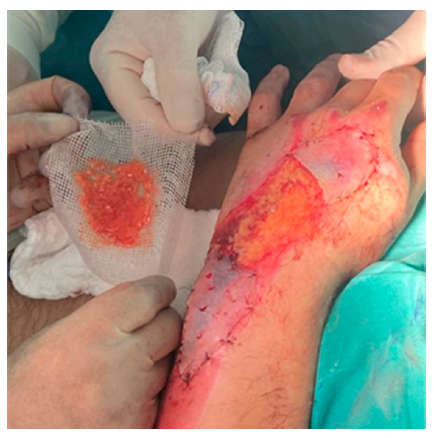 Jcm 13 05640 g003 Jcm 13 05640 g003