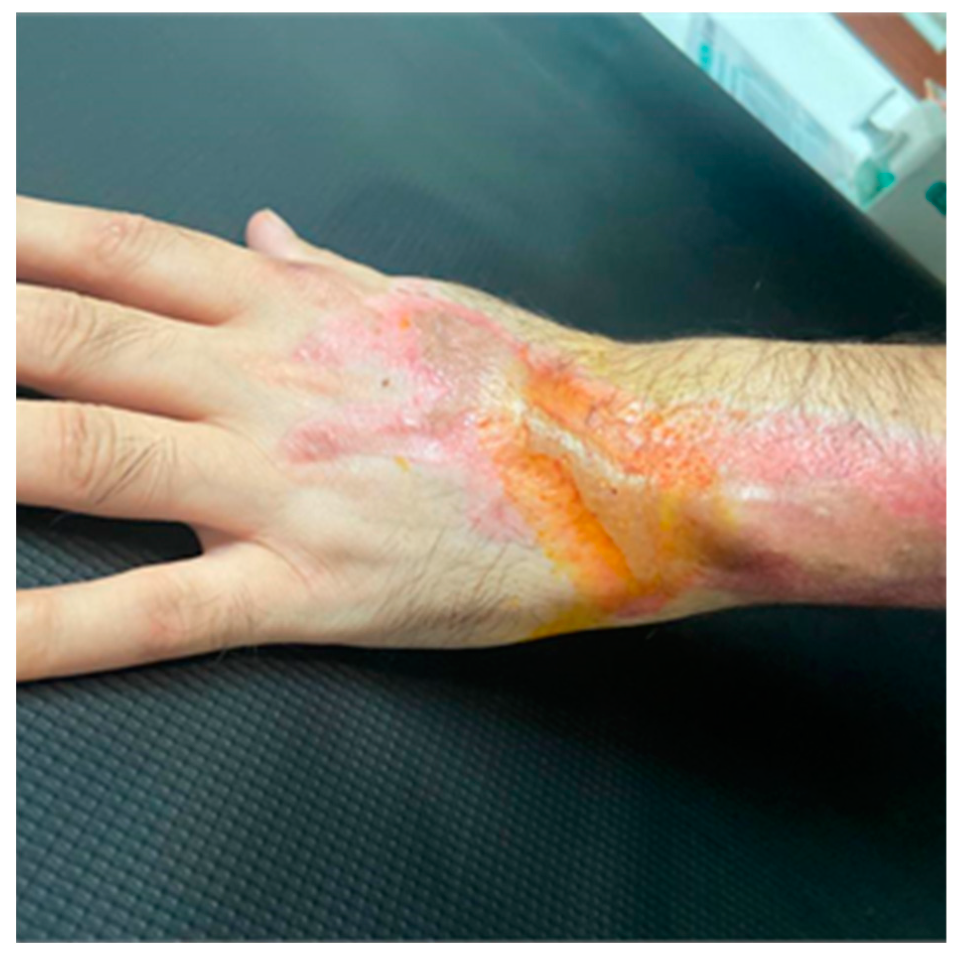 Jcm 13 05640 g004 Jcm 13 05640 g004