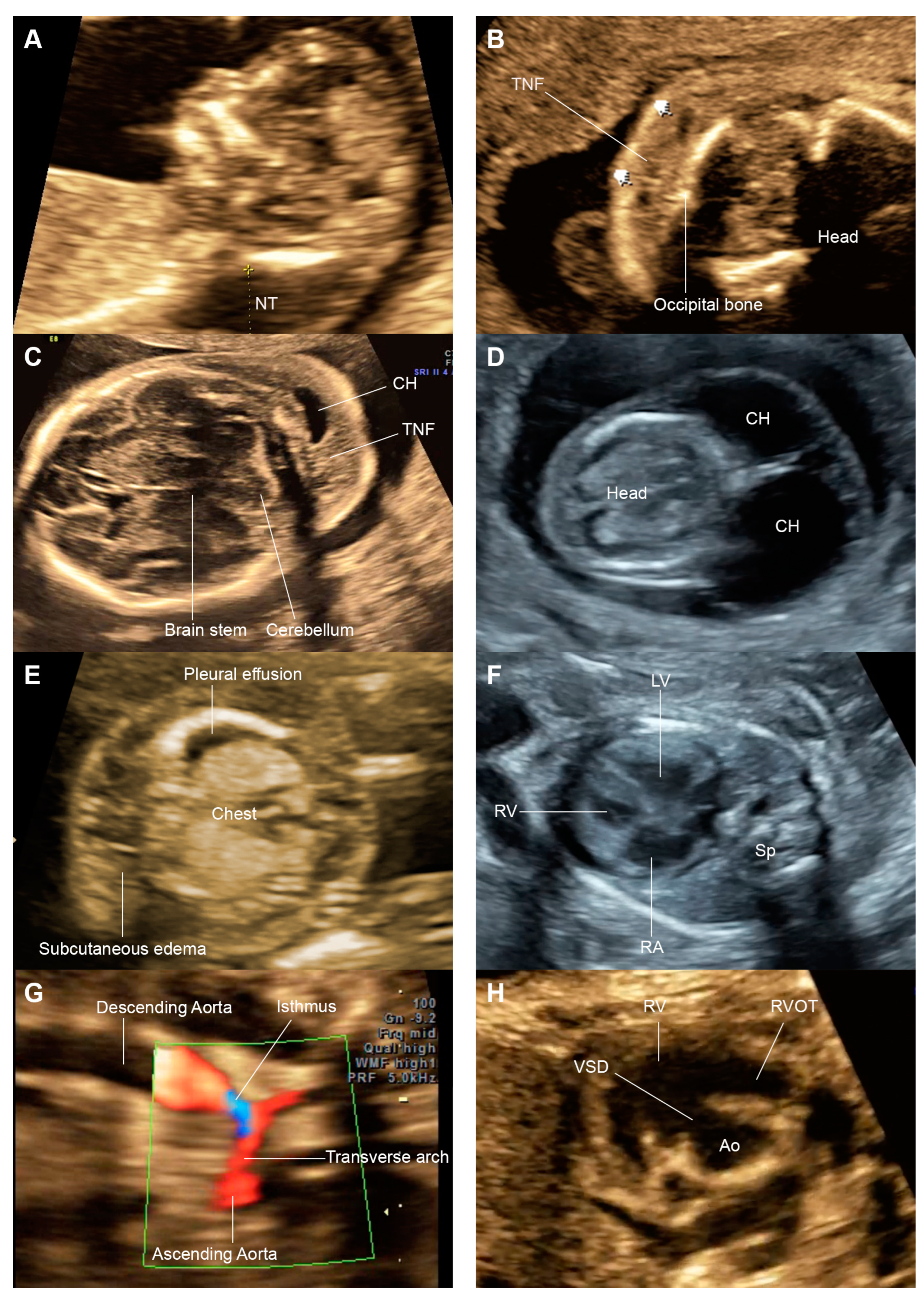 Jcm 13 05735 g001 Jcm 13 05735 g001