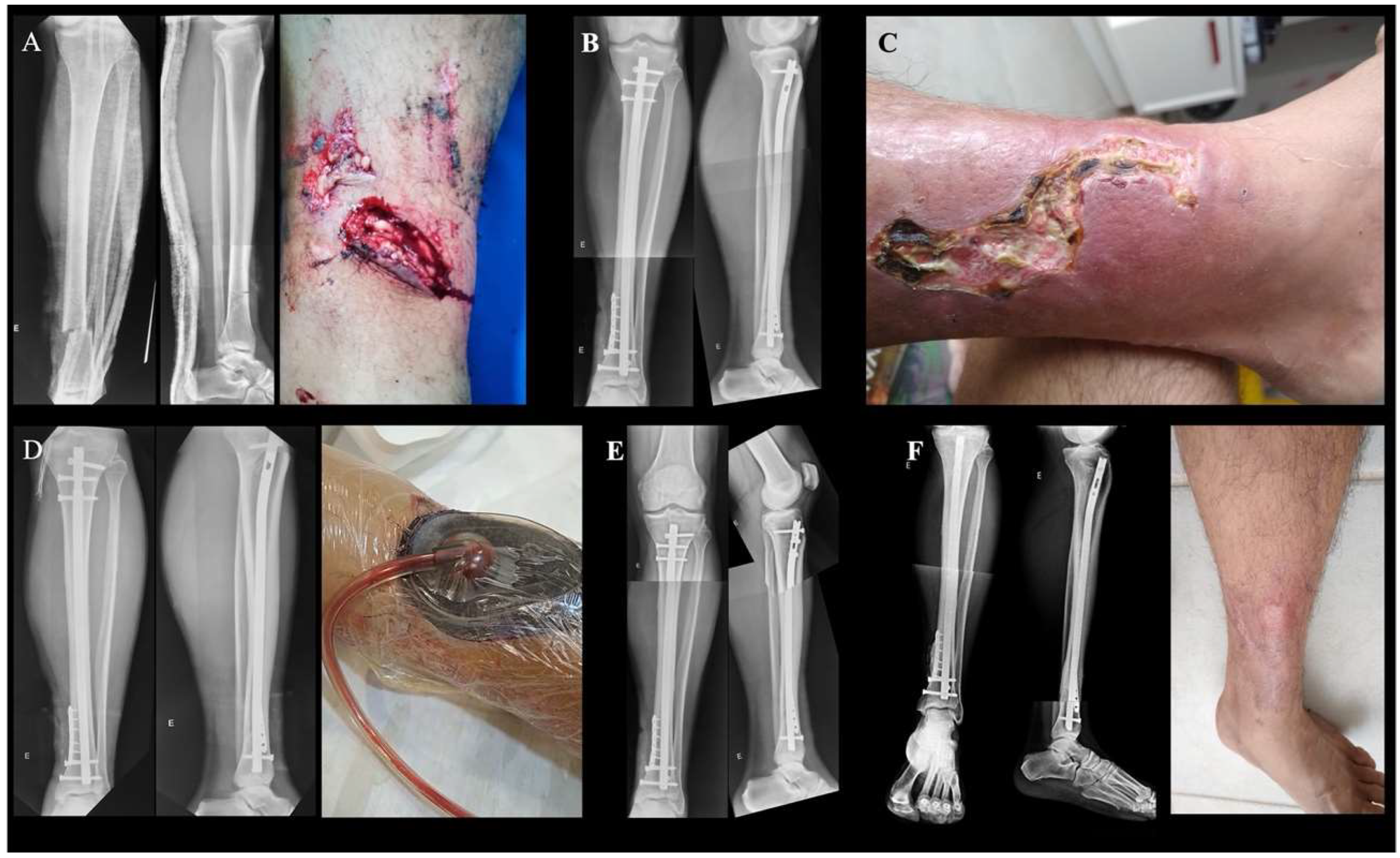 Jcm 13 05779 g001 Jcm 13 05779 g001