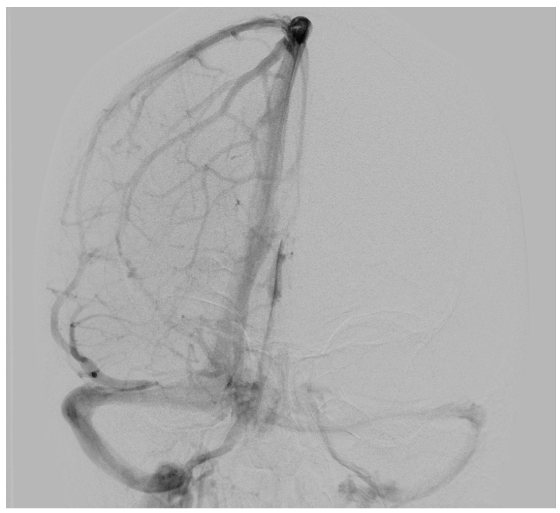 Jcm 13 05813 g002 Jcm 13 05813 g002