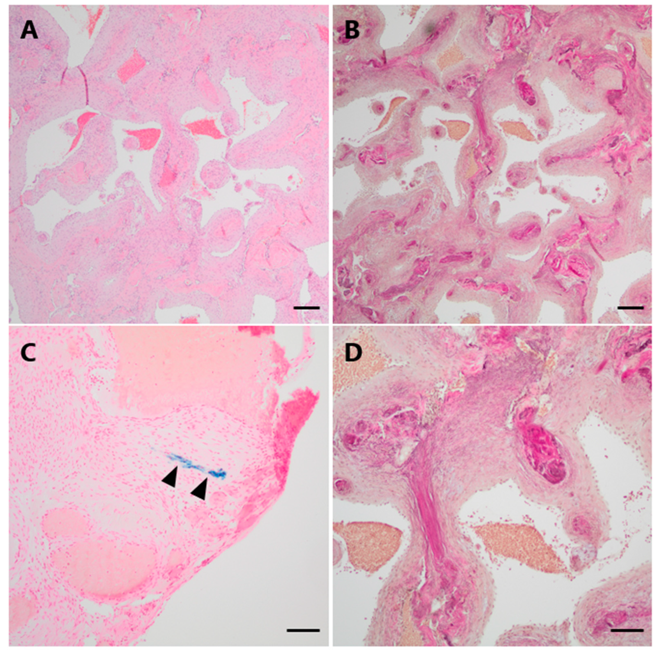 Jcm 13 05813 g003 Jcm 13 05813 g003