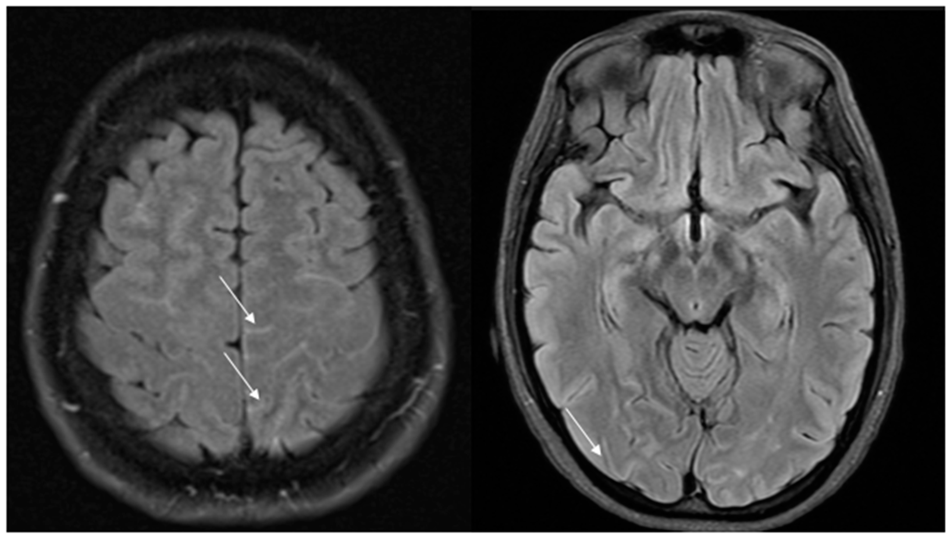 Jcm 13 05930 g002 Jcm 13 05930 g002