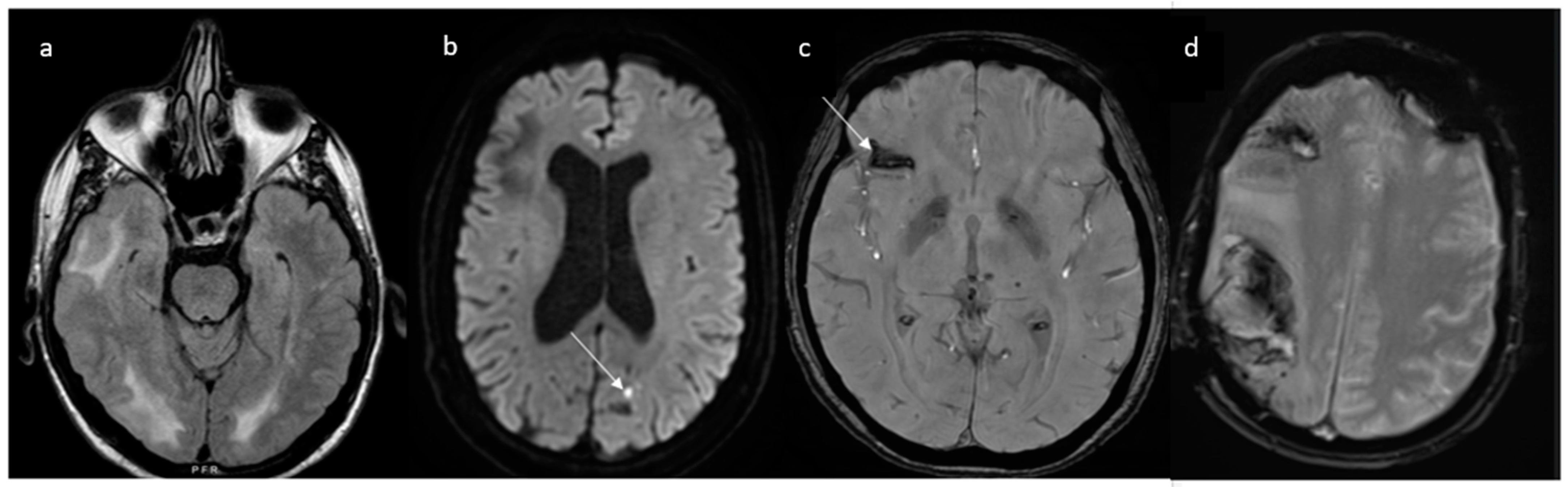 Jcm 13 05930 g005 Jcm 13 05930 g005