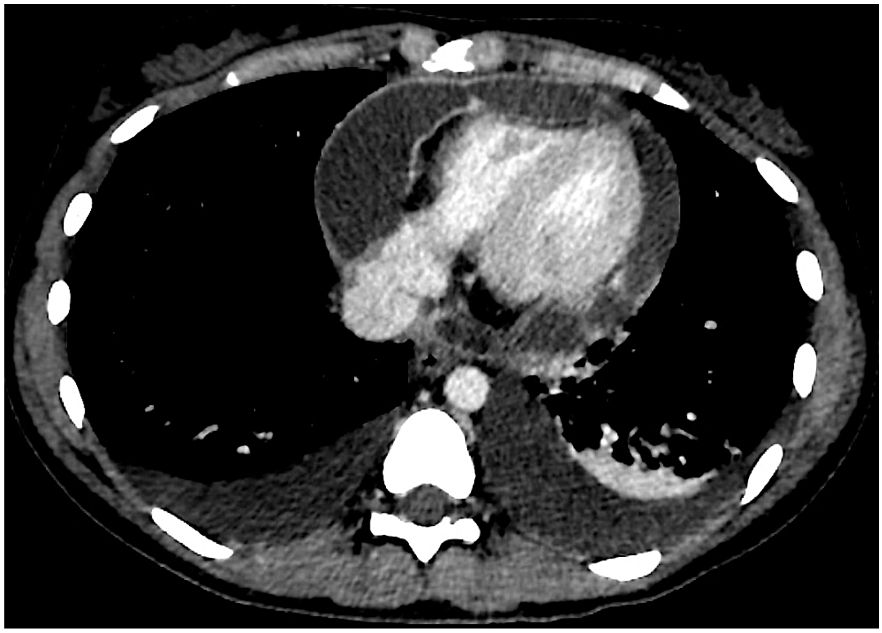 Jcm 13 06051 g001 Jcm 13 06051 g001