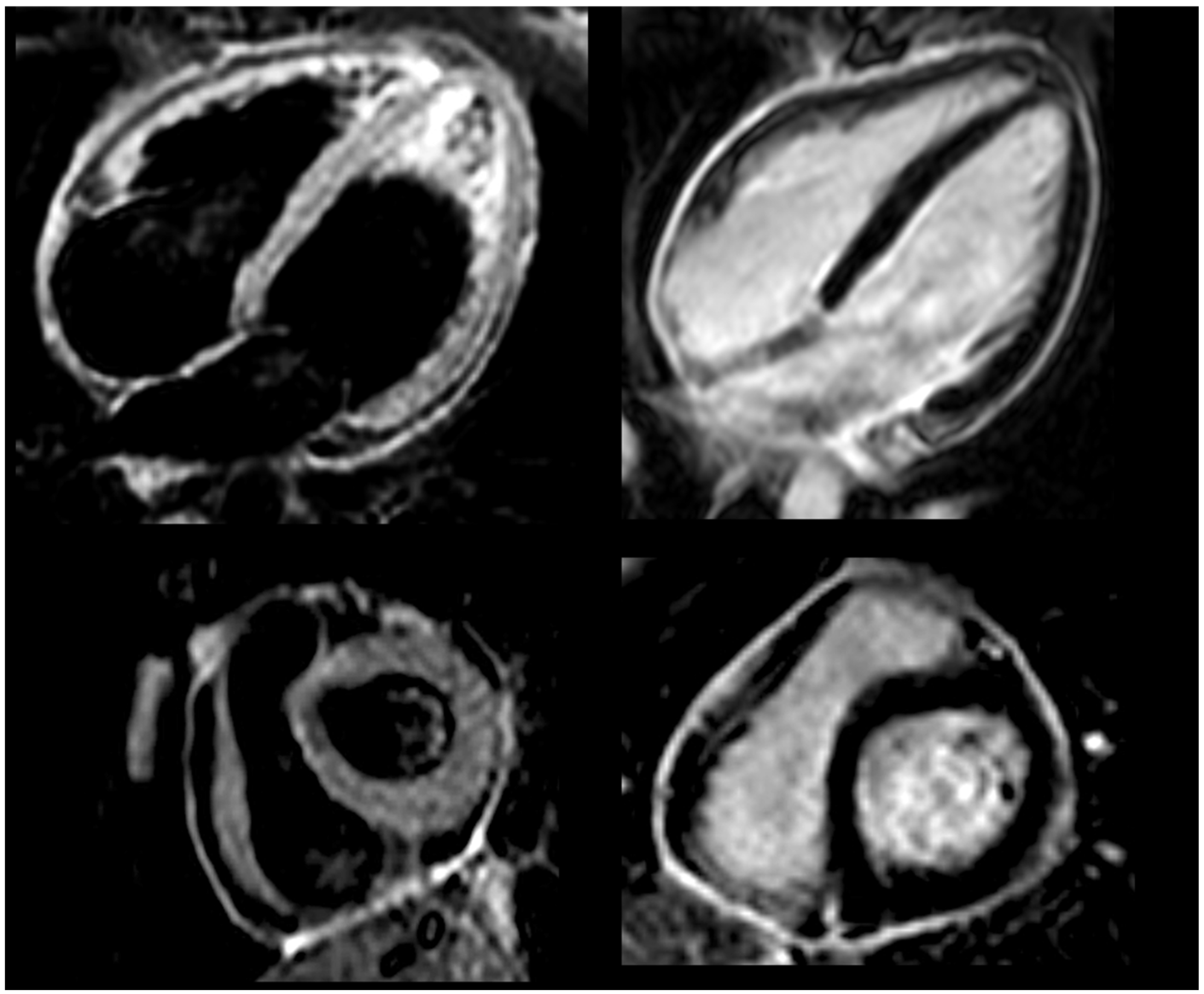 Jcm 13 06051 g002 Jcm 13 06051 g002