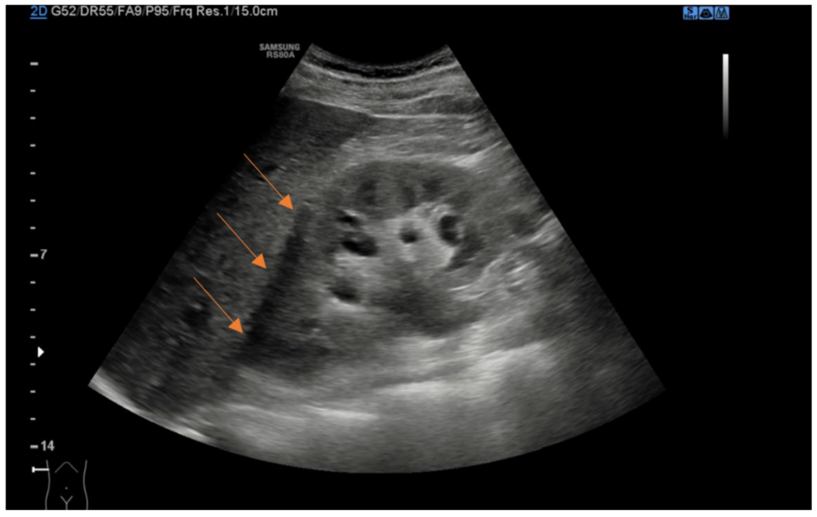 Jcm 13 06118 g001 Jcm 13 06118 g001