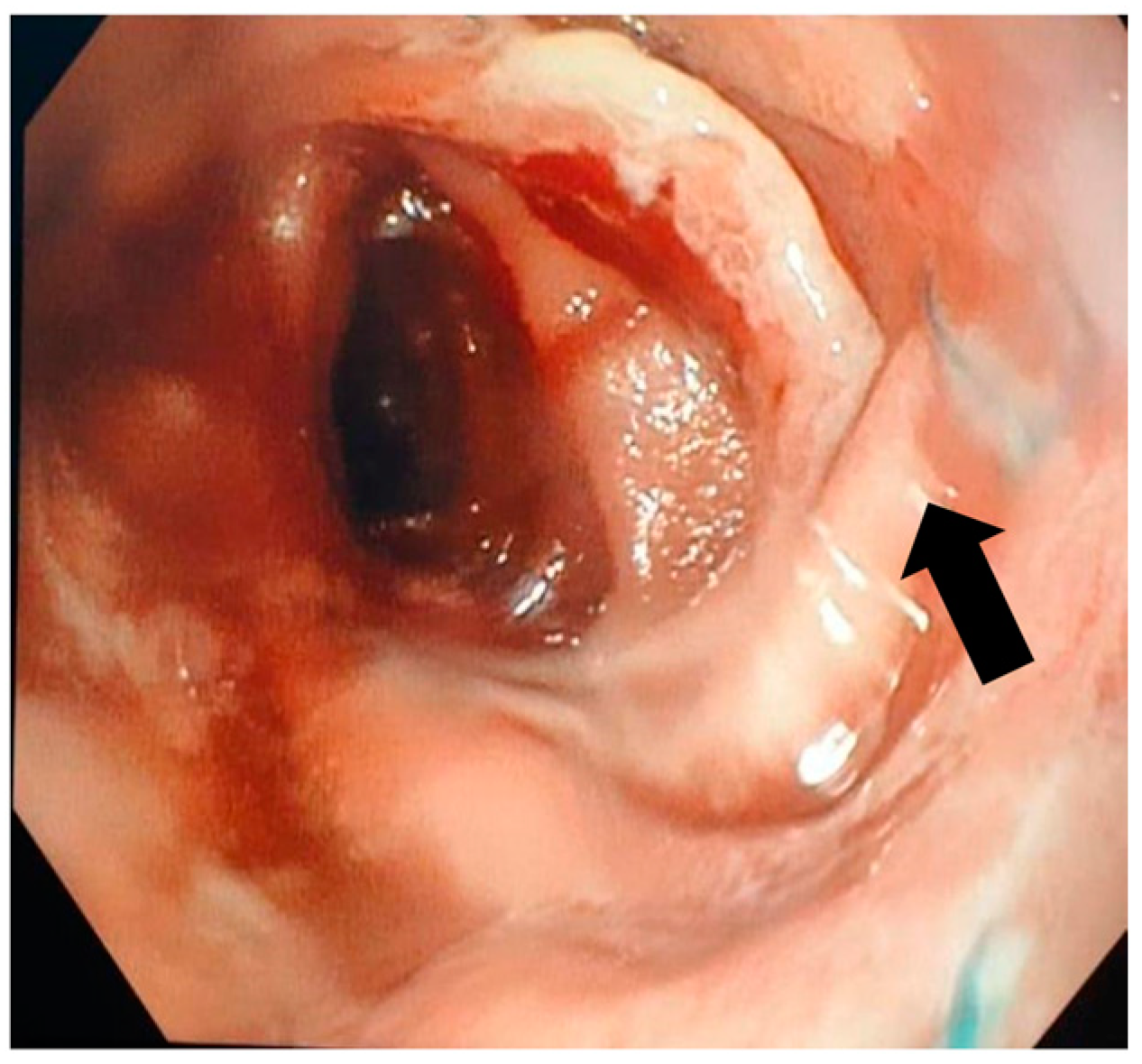 Jcm 13 06167 g003 Jcm 13 06167 g003