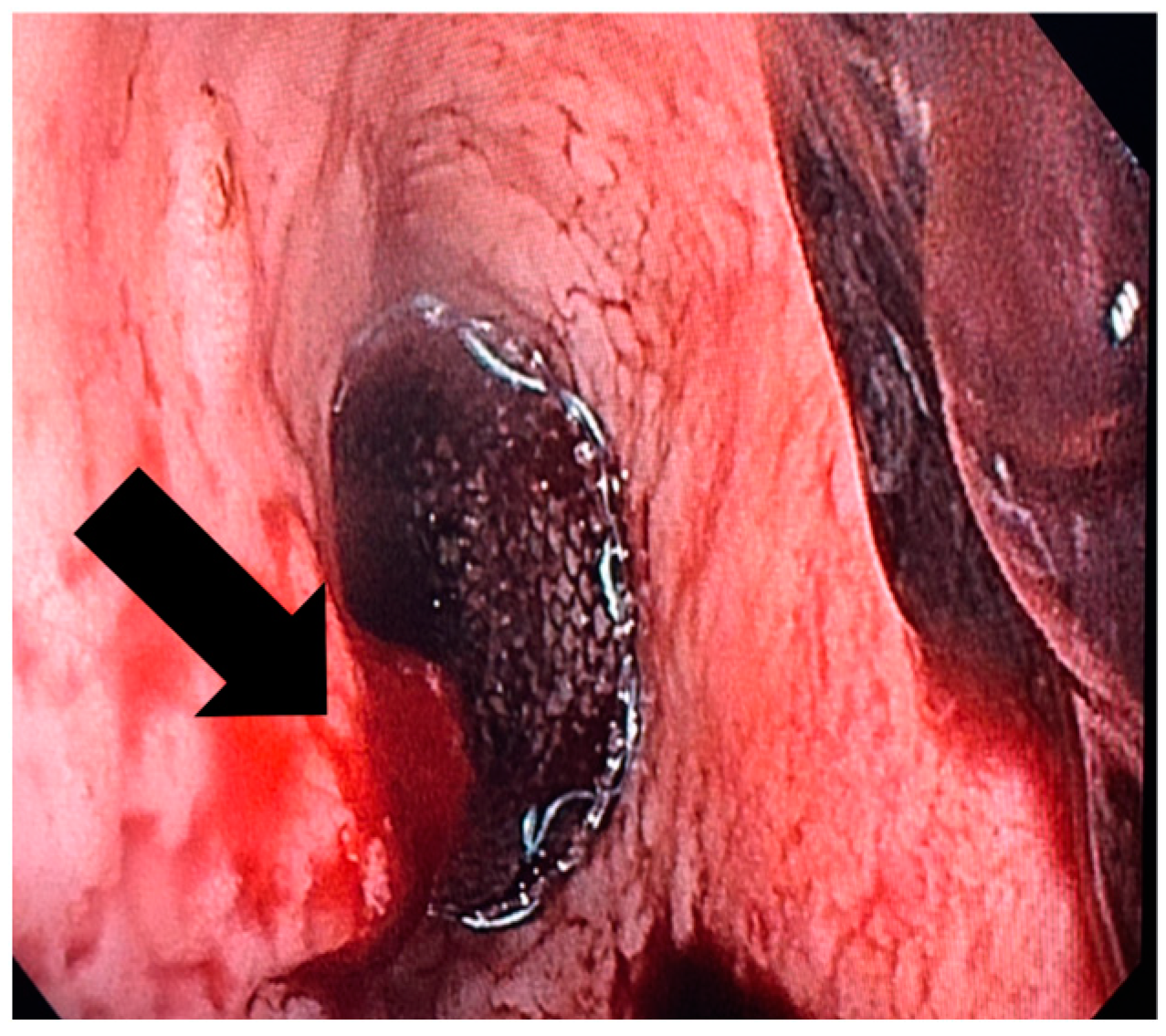 Jcm 13 06167 g005 Jcm 13 06167 g005