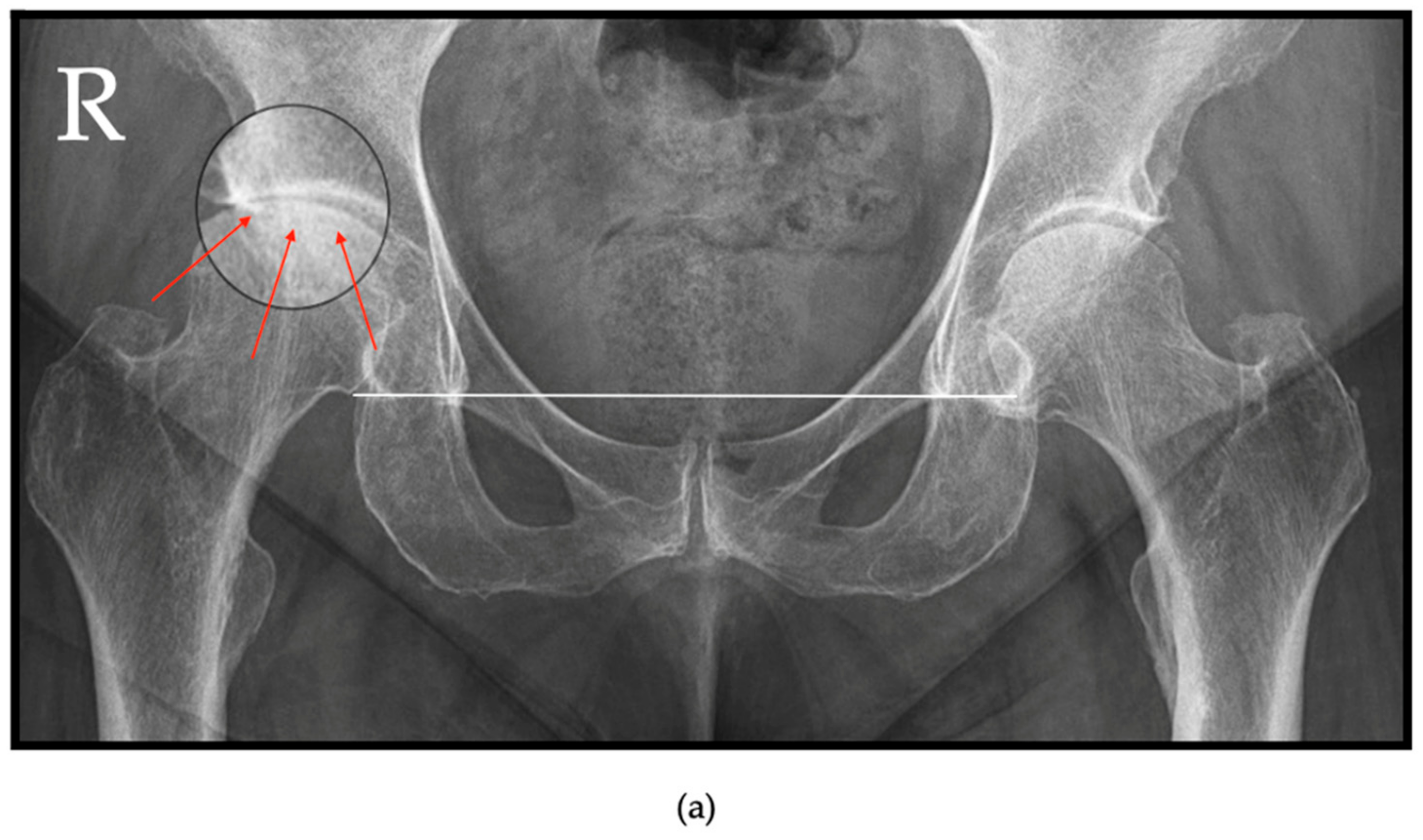 Jcm 13 06194 g002a Jcm 13 06194 g002a
