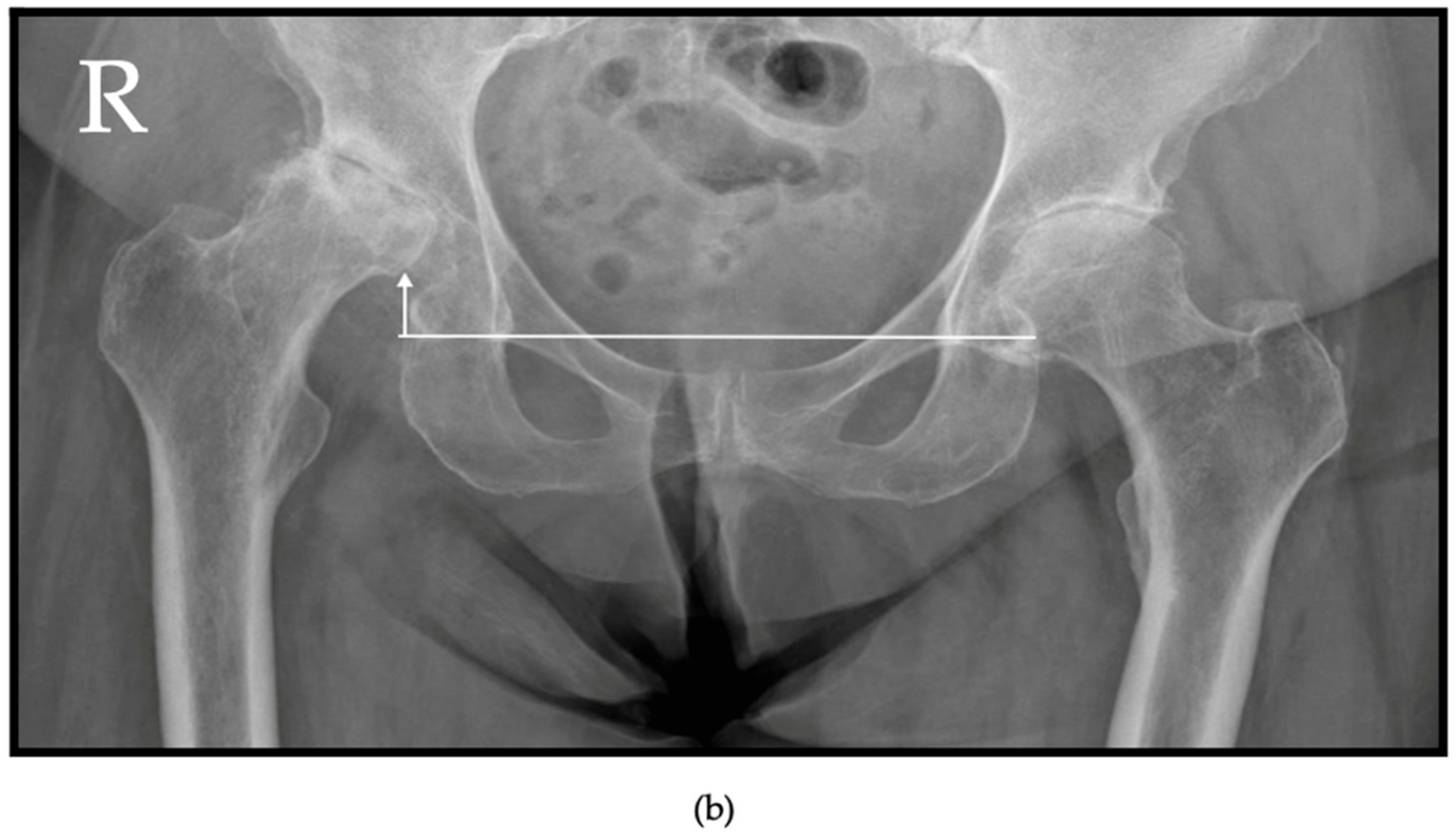 Jcm 13 06194 g002b Jcm 13 06194 g002b