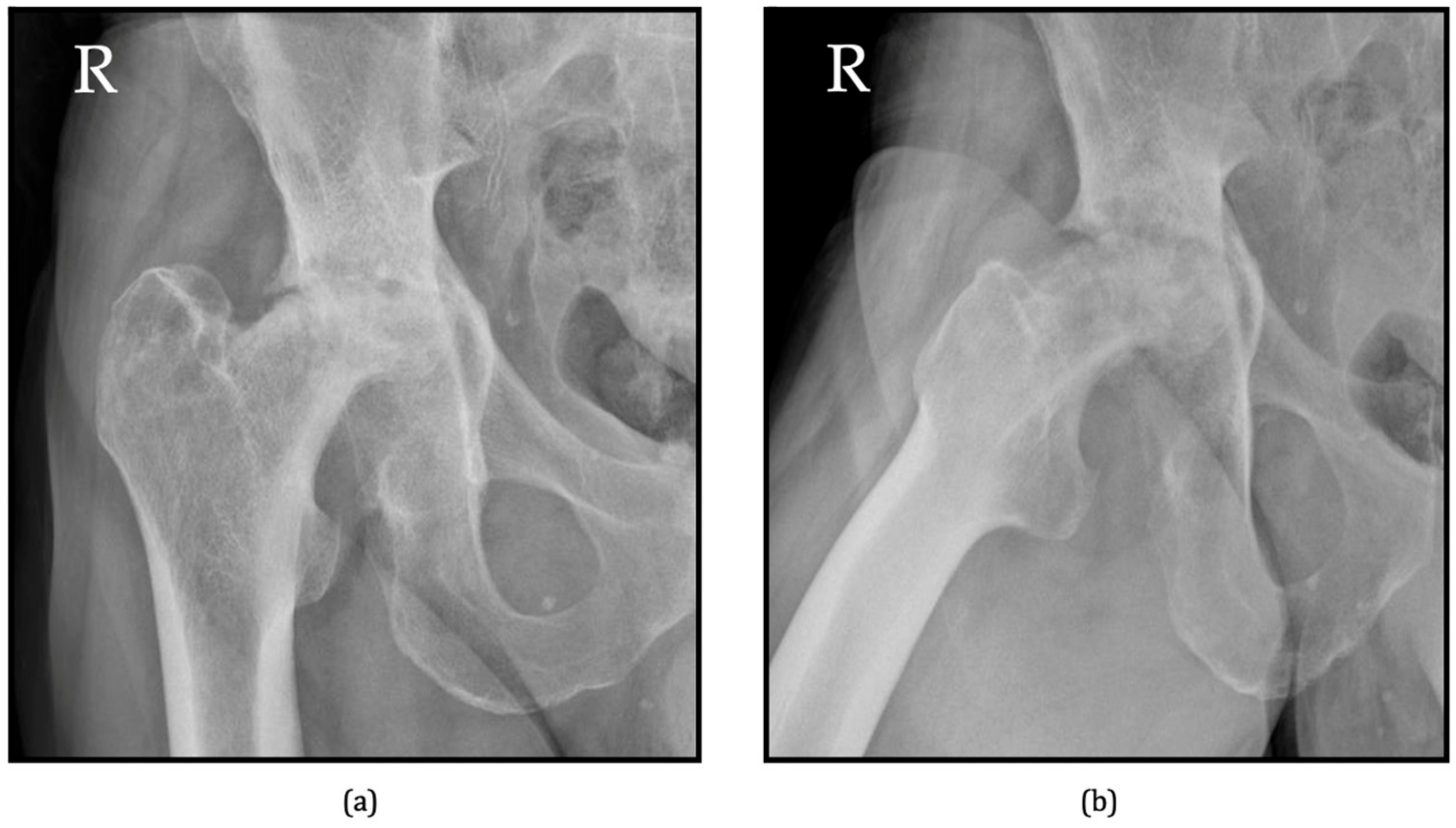 Jcm 13 06194 g003a Jcm 13 06194 g003a