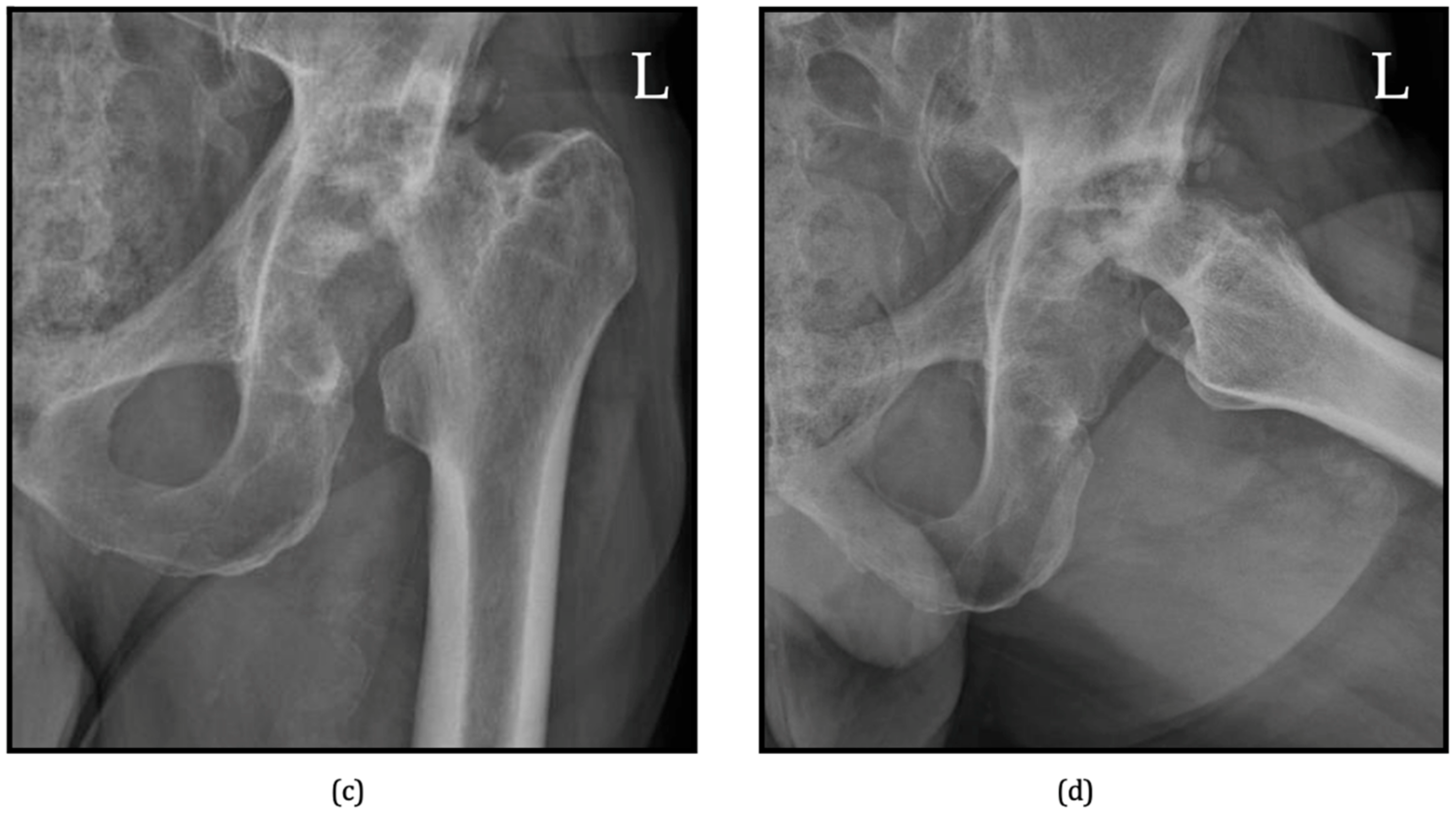 Jcm 13 06194 g003b Jcm 13 06194 g003b