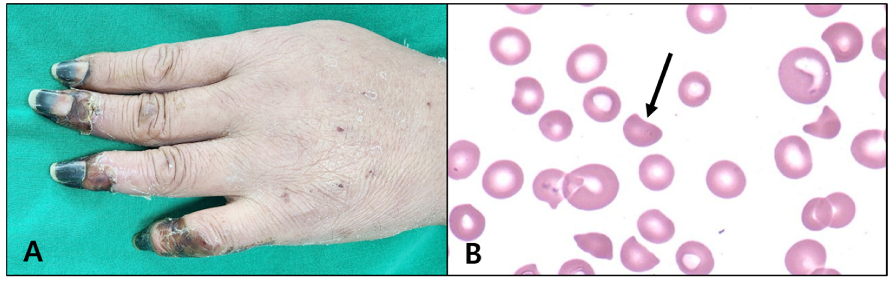 Jcm 13 06527 g001 Jcm 13 06527 g001