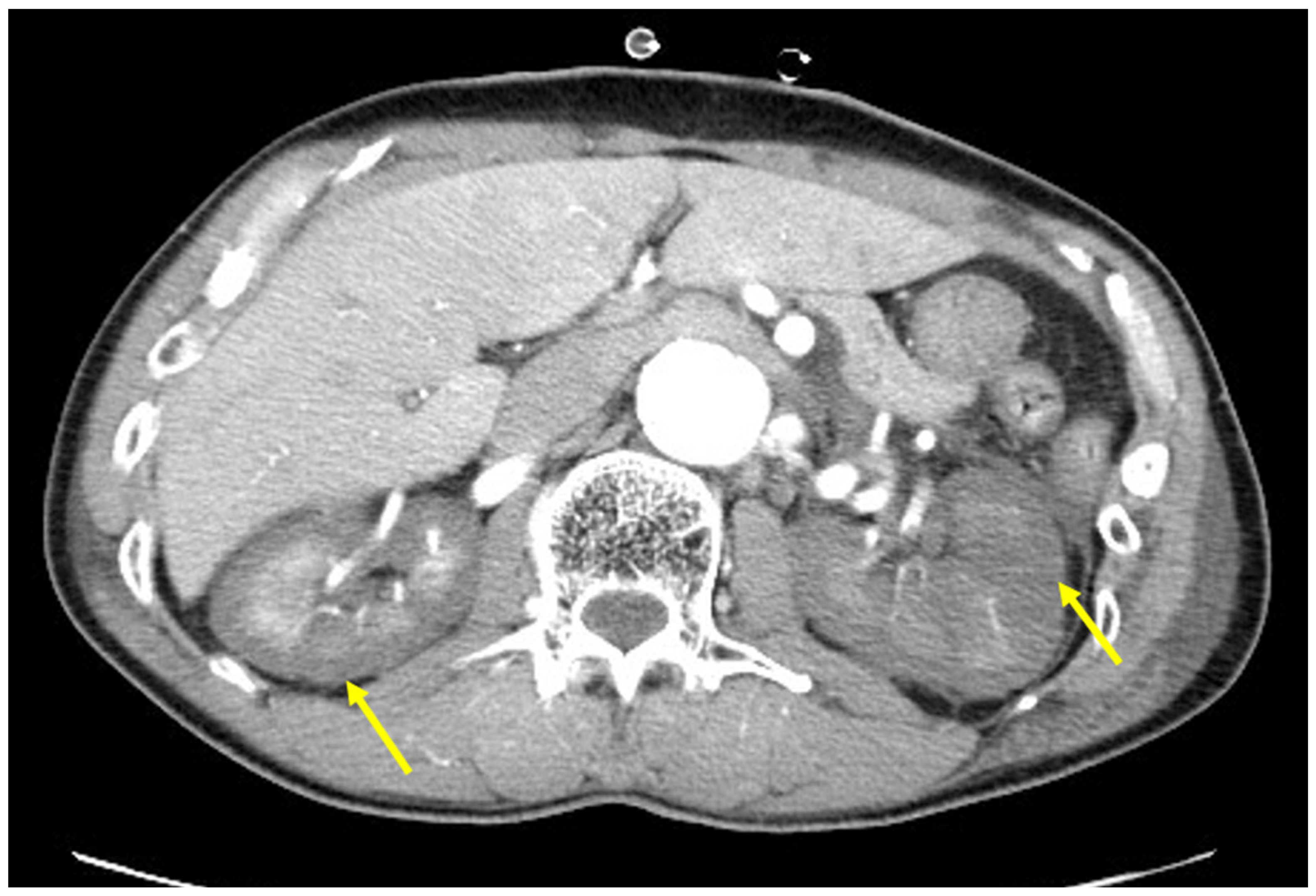 Jcm 13 06527 g002 Jcm 13 06527 g002