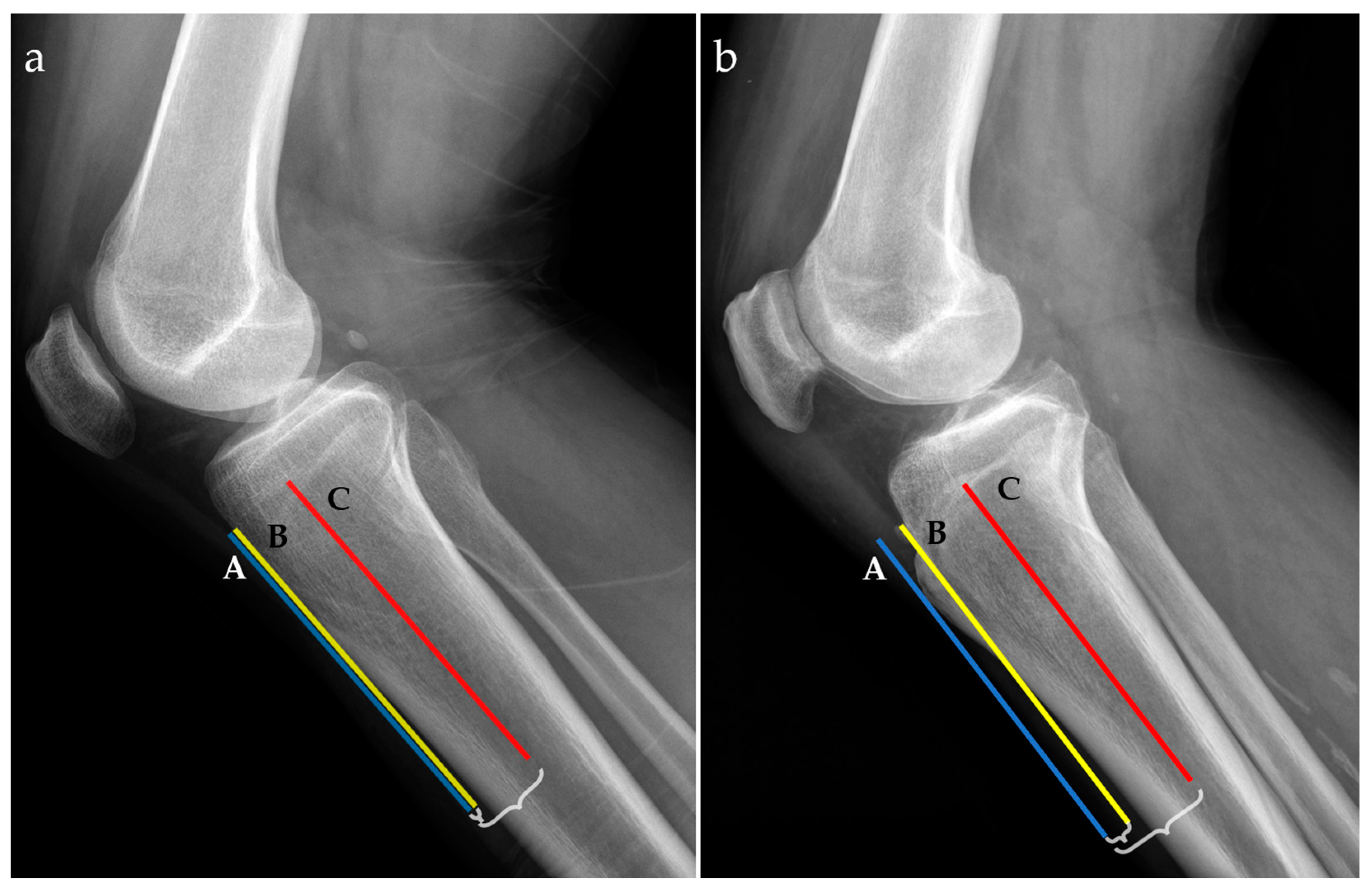 An MRI-Based Method for the Morphologic Assessment of the