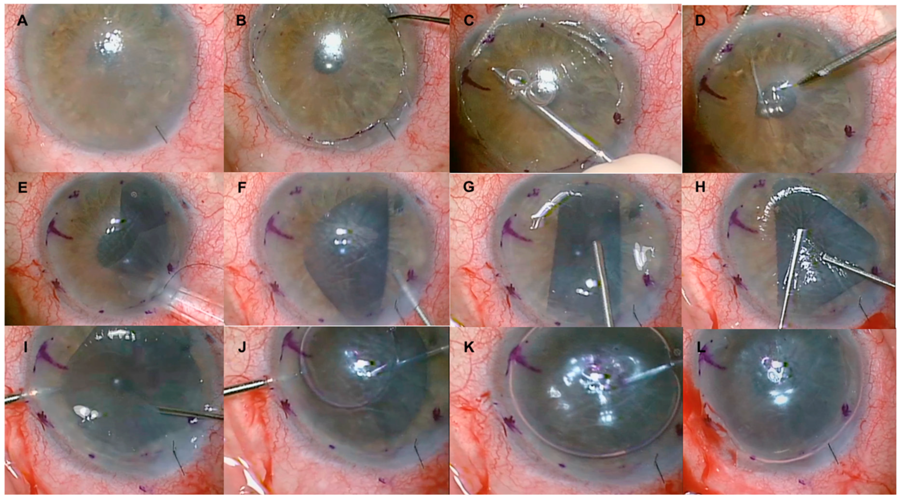 Jcm 13 06654 g002 Jcm 13 06654 g002