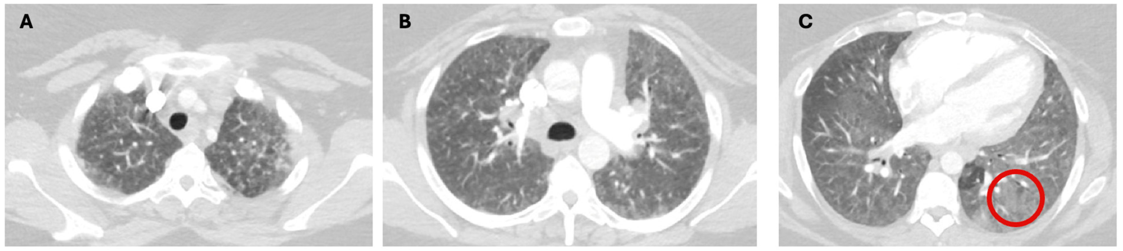 Jcm 13 06657 g002 Jcm 13 06657 g002