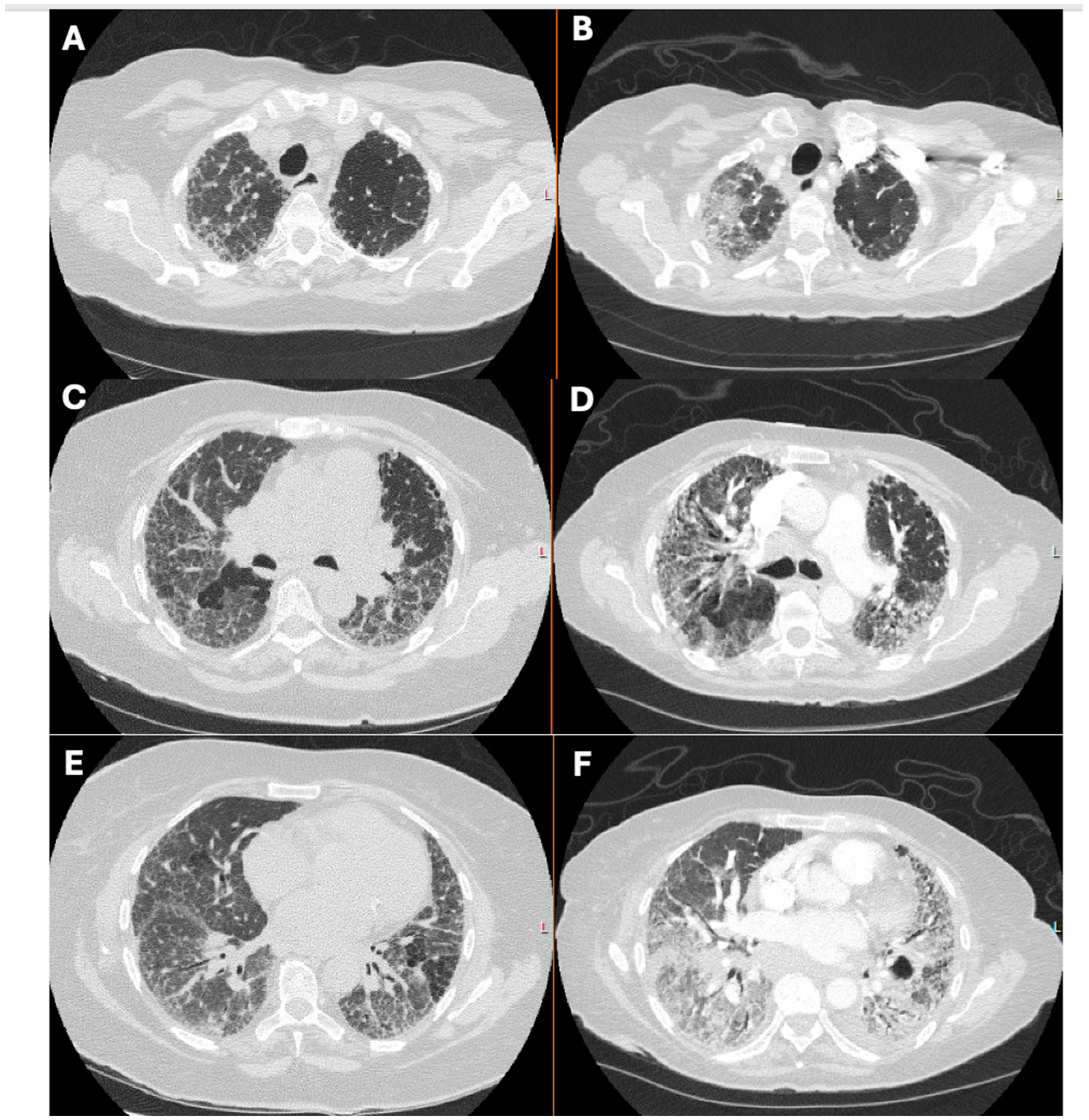 Jcm 13 06657 g003 Jcm 13 06657 g003