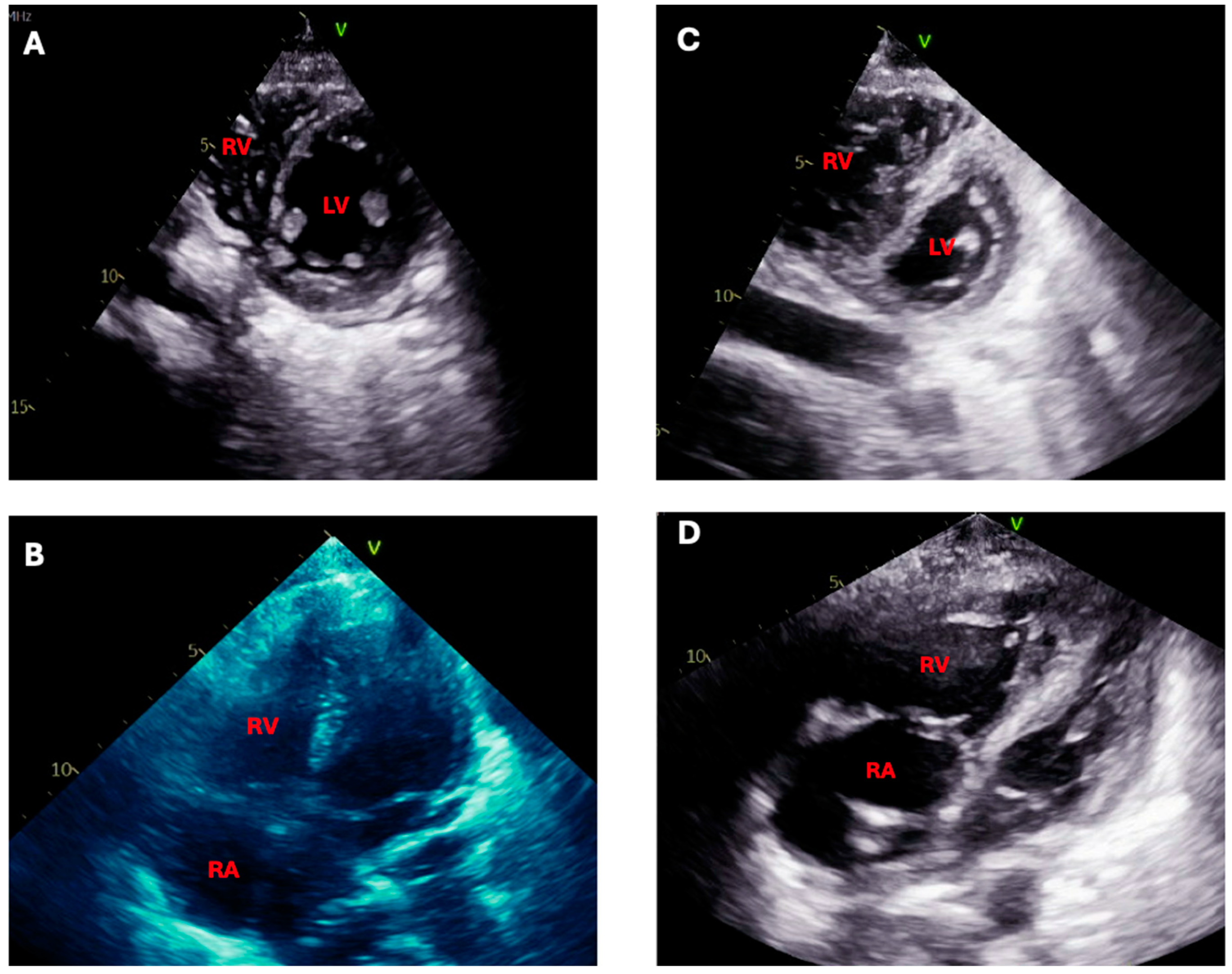 Jcm 13 06657 g005 Jcm 13 06657 g005