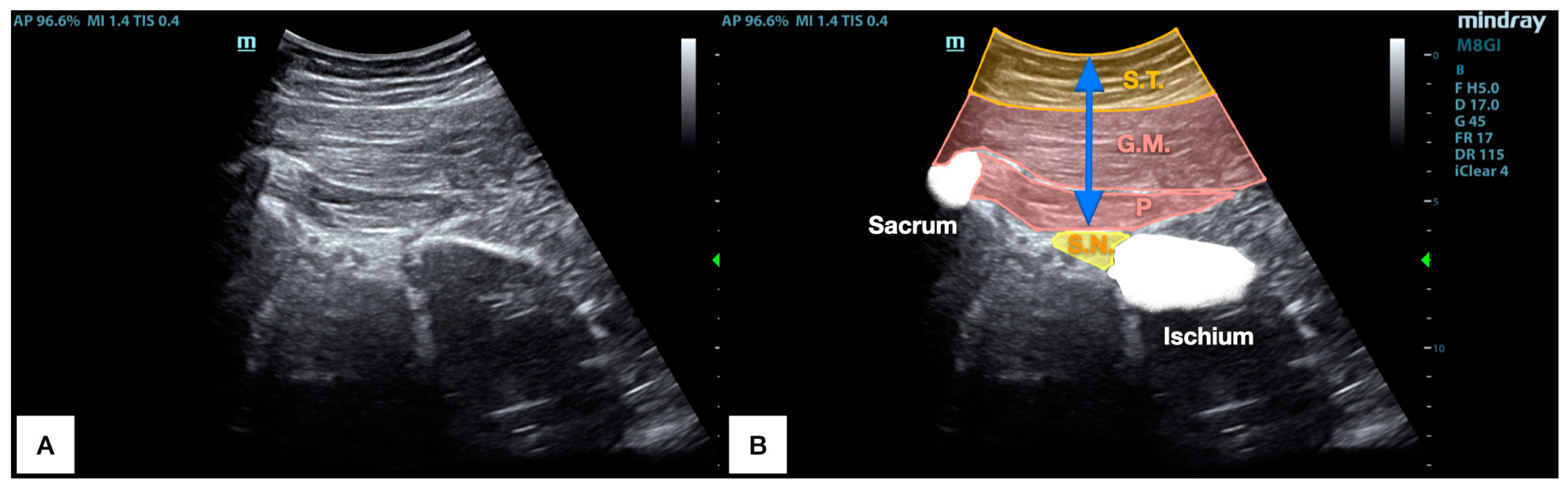 Jcm 13 06674 g003 Jcm 13 06674 g003