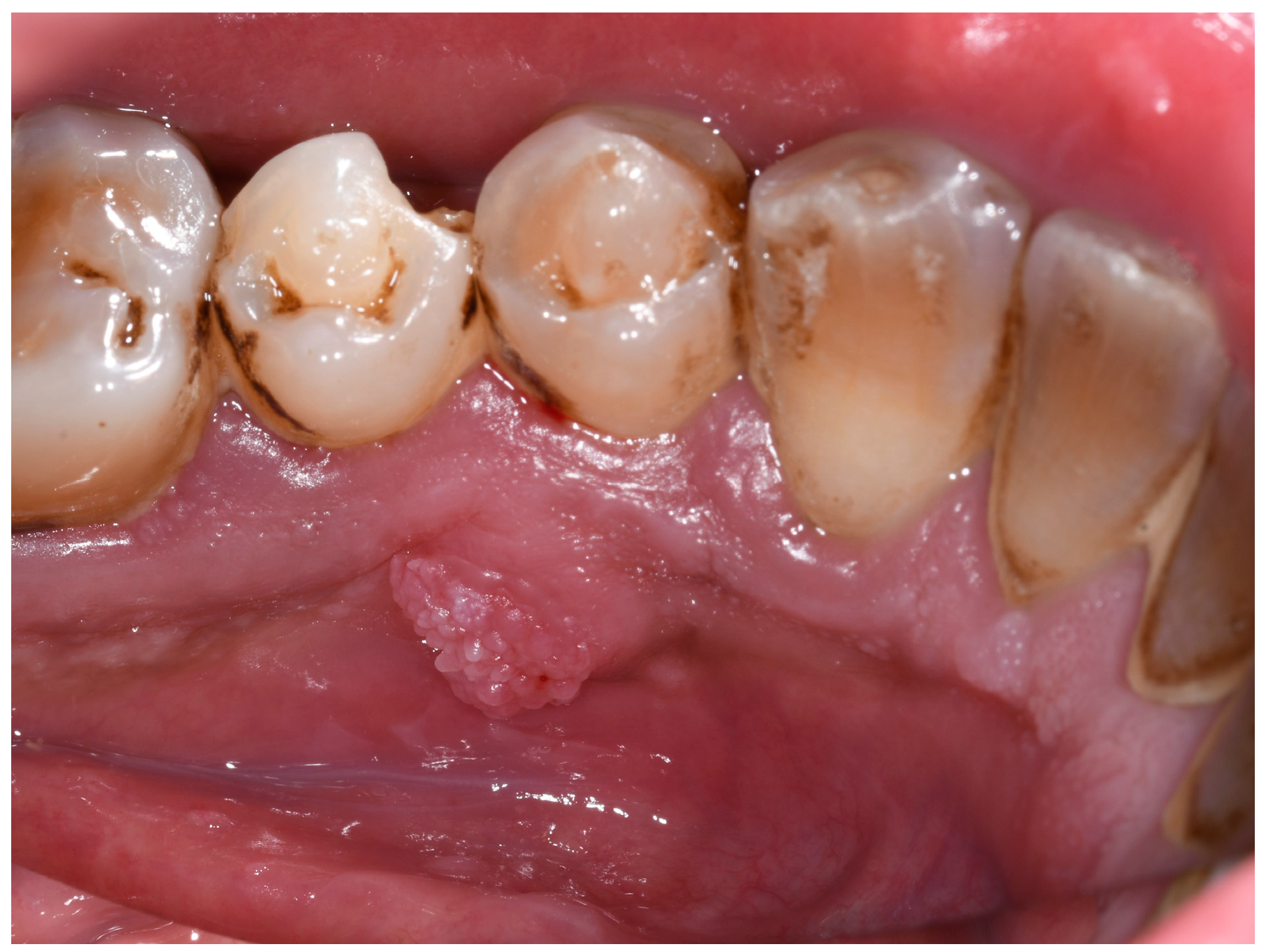 Jcm 13 06714 g001 Jcm 13 06714 g001