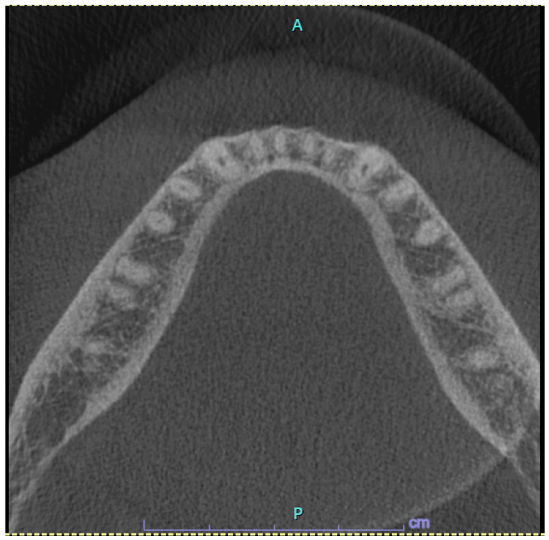 Jcm 13 06714 g002 Jcm 13 06714 g002