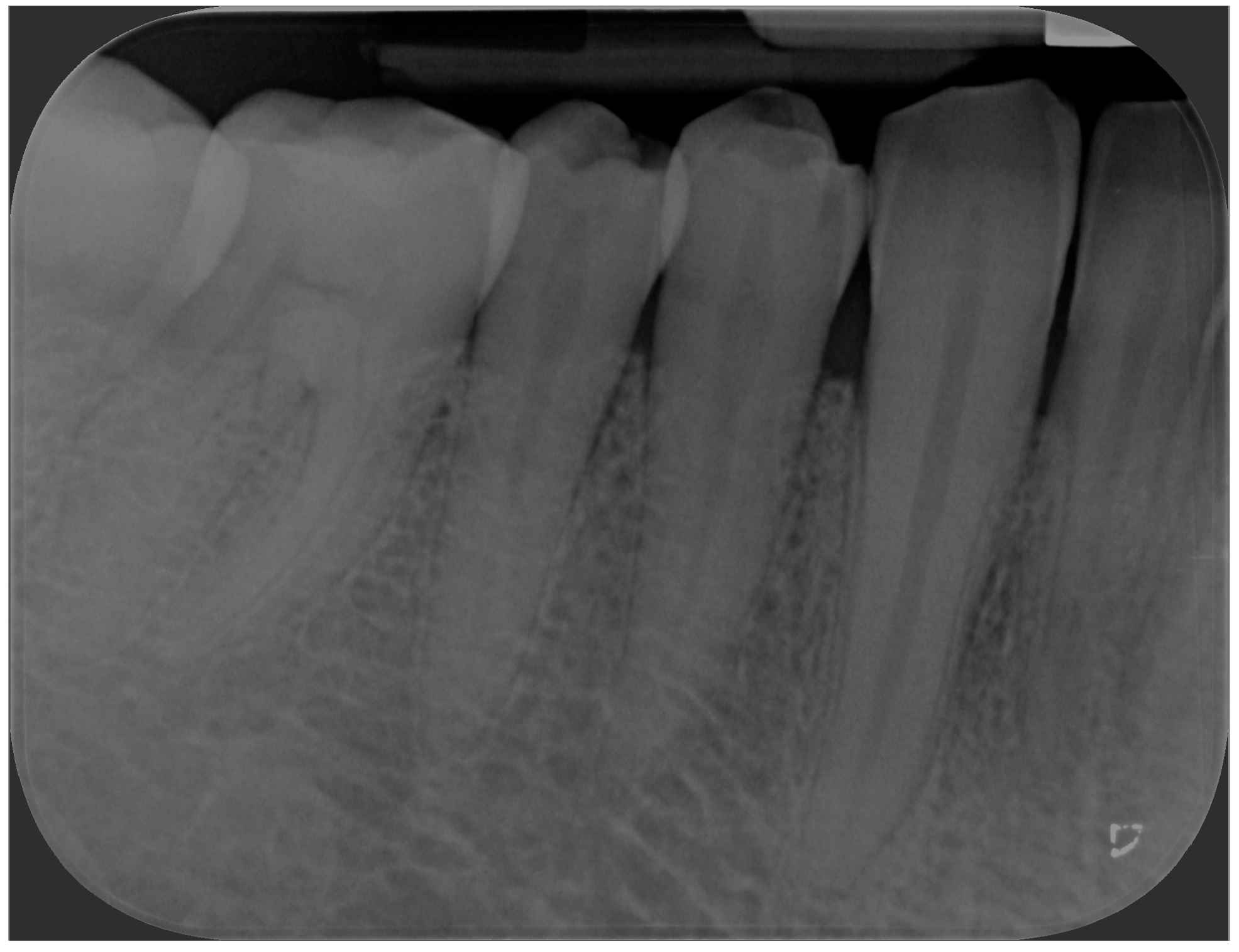 Jcm 13 06714 g005 Jcm 13 06714 g005