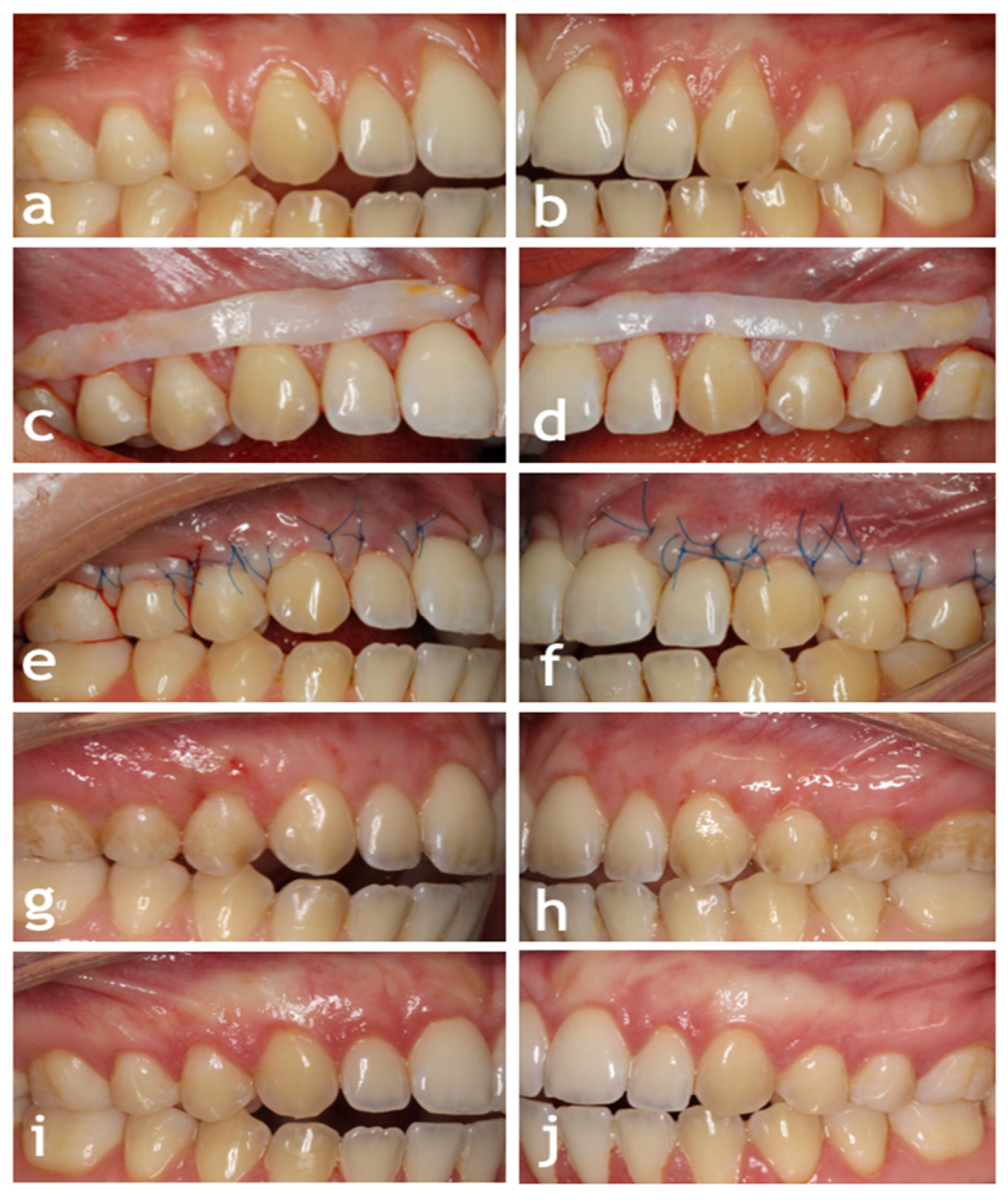 Jcm 13 06758 g002 Jcm 13 06758 g002