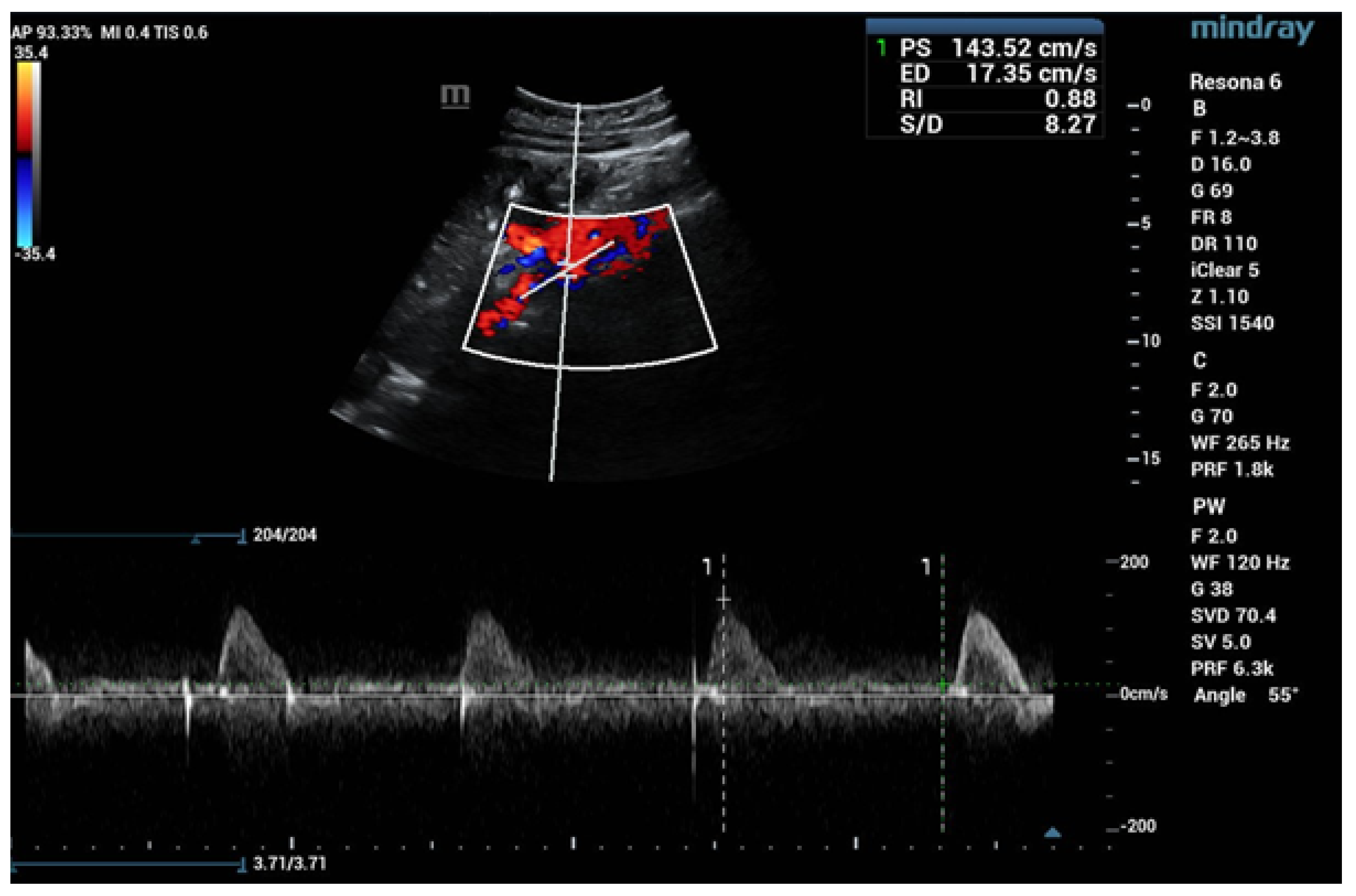 Jcm 13 06778 g004 Jcm 13 06778 g004
